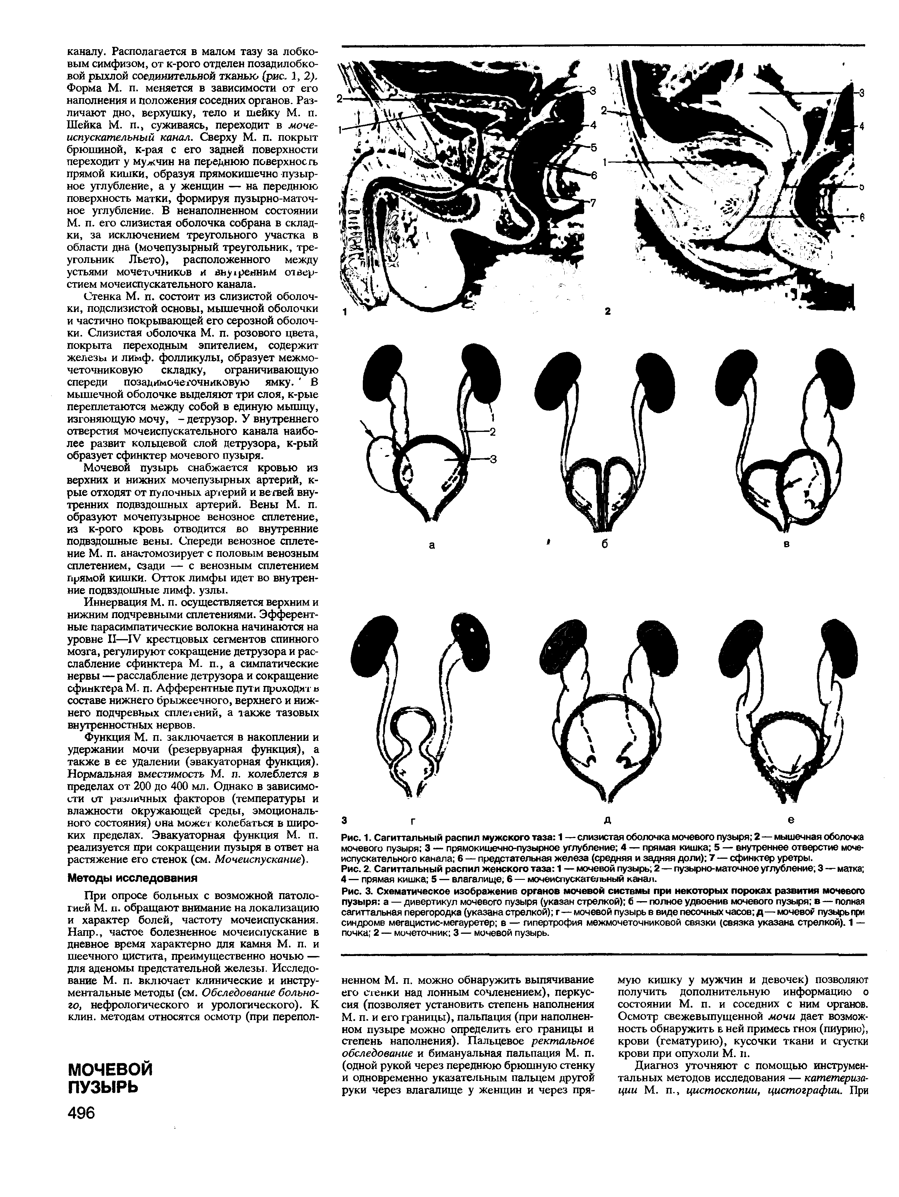 Рис. 1. Сагиттальный распил мужского таза 1 — слизистая оболочка мочевого пузыря 2—мышечная оболочка мочевого пузыря 3 — прямокишечно-пузырное углубление 4 — прямая кишка 5 — внутреннее отверстие мочеиспускательного канала 6 — предстательная железа (средняя и задняя доли) 7 — сфинктер уретры.