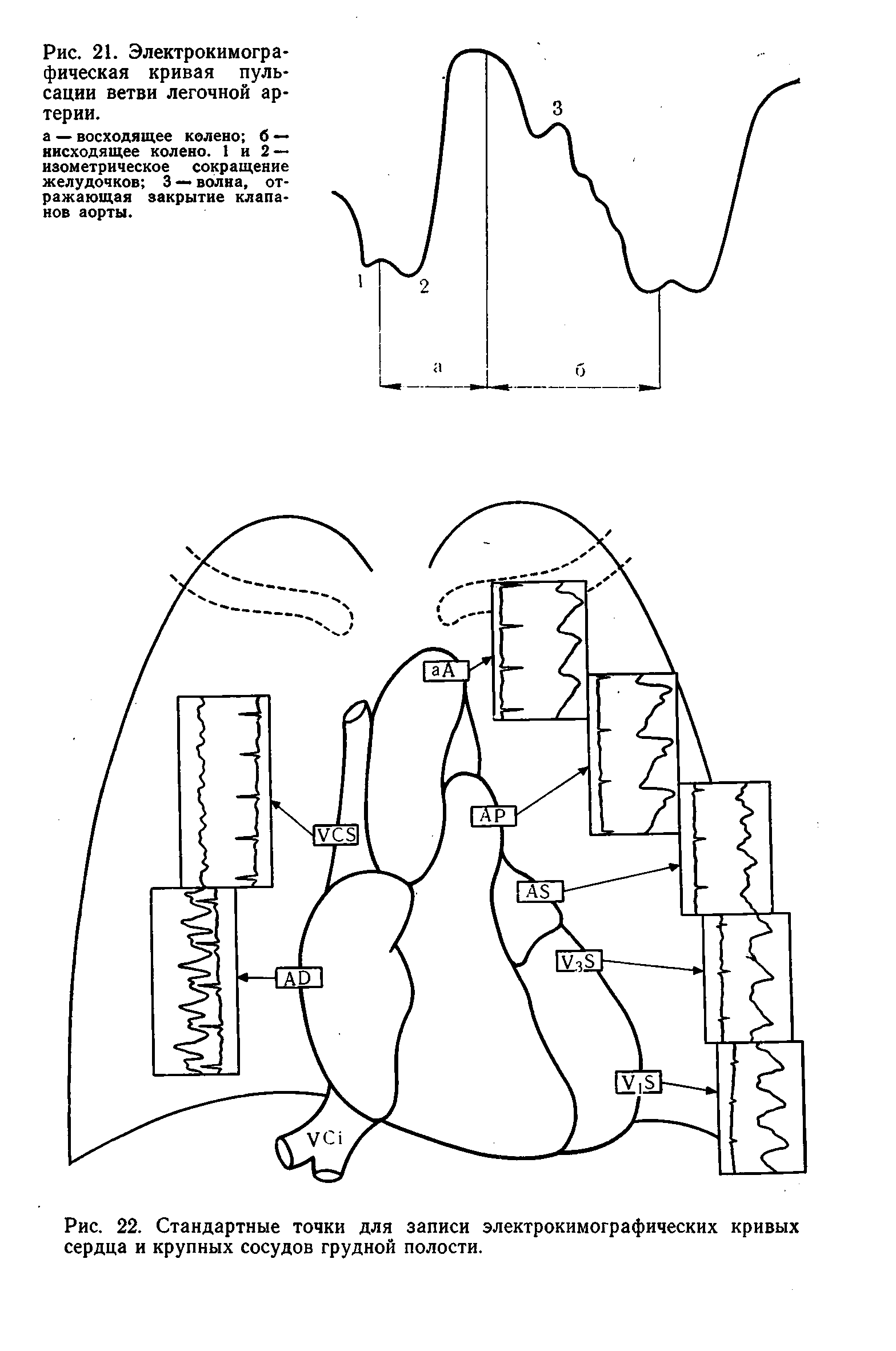 Рис. 22. Стандартные точки для записи электрокимографических кривых сердца и крупных сосудов грудной полости.