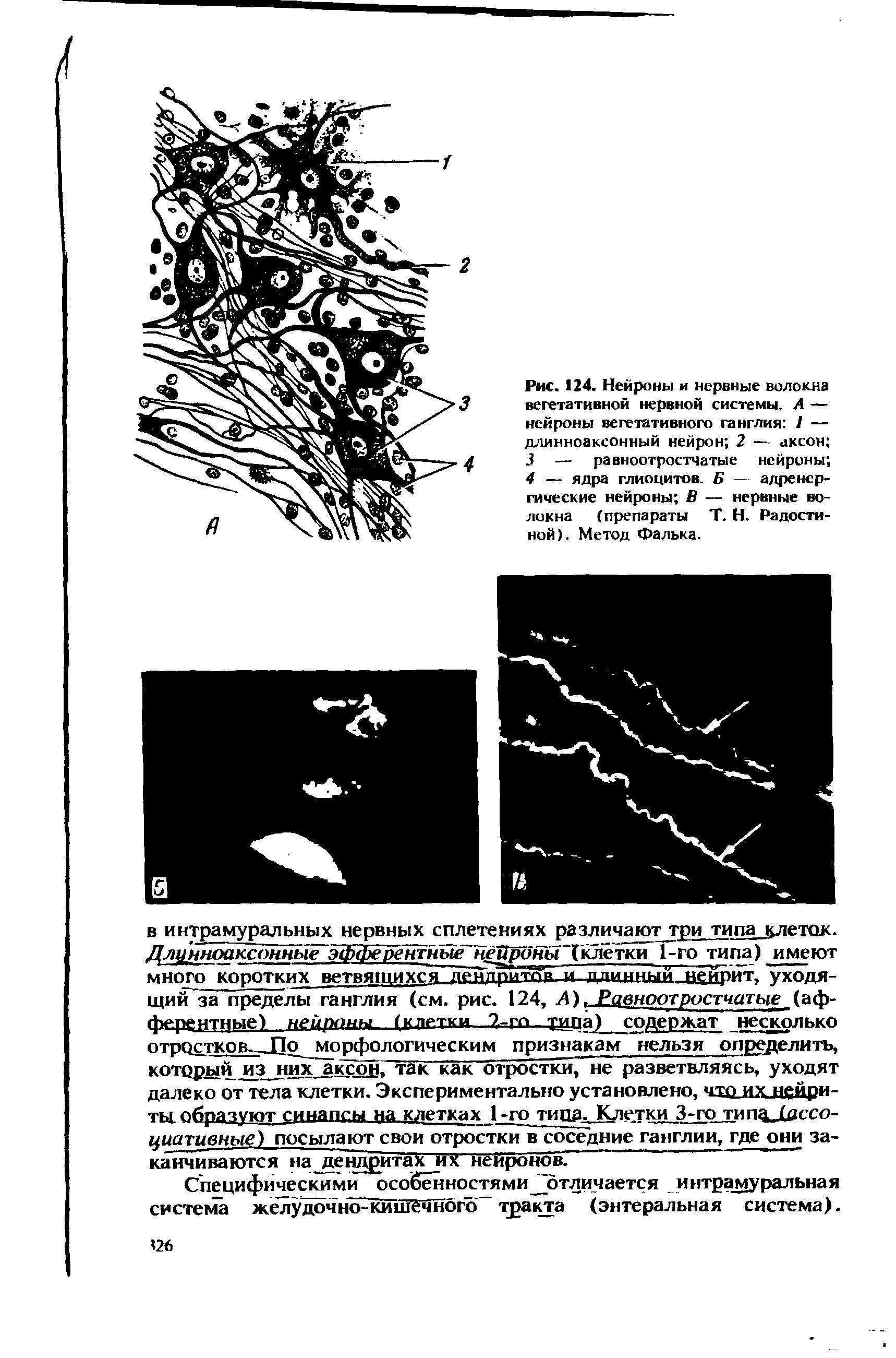 Рис. 124. Нейроны и нервные волокна вегетативной нервной системы. А — нейроны вегетативного ганглия 1 — длинноаксонный нейрон 2 — аксон ...