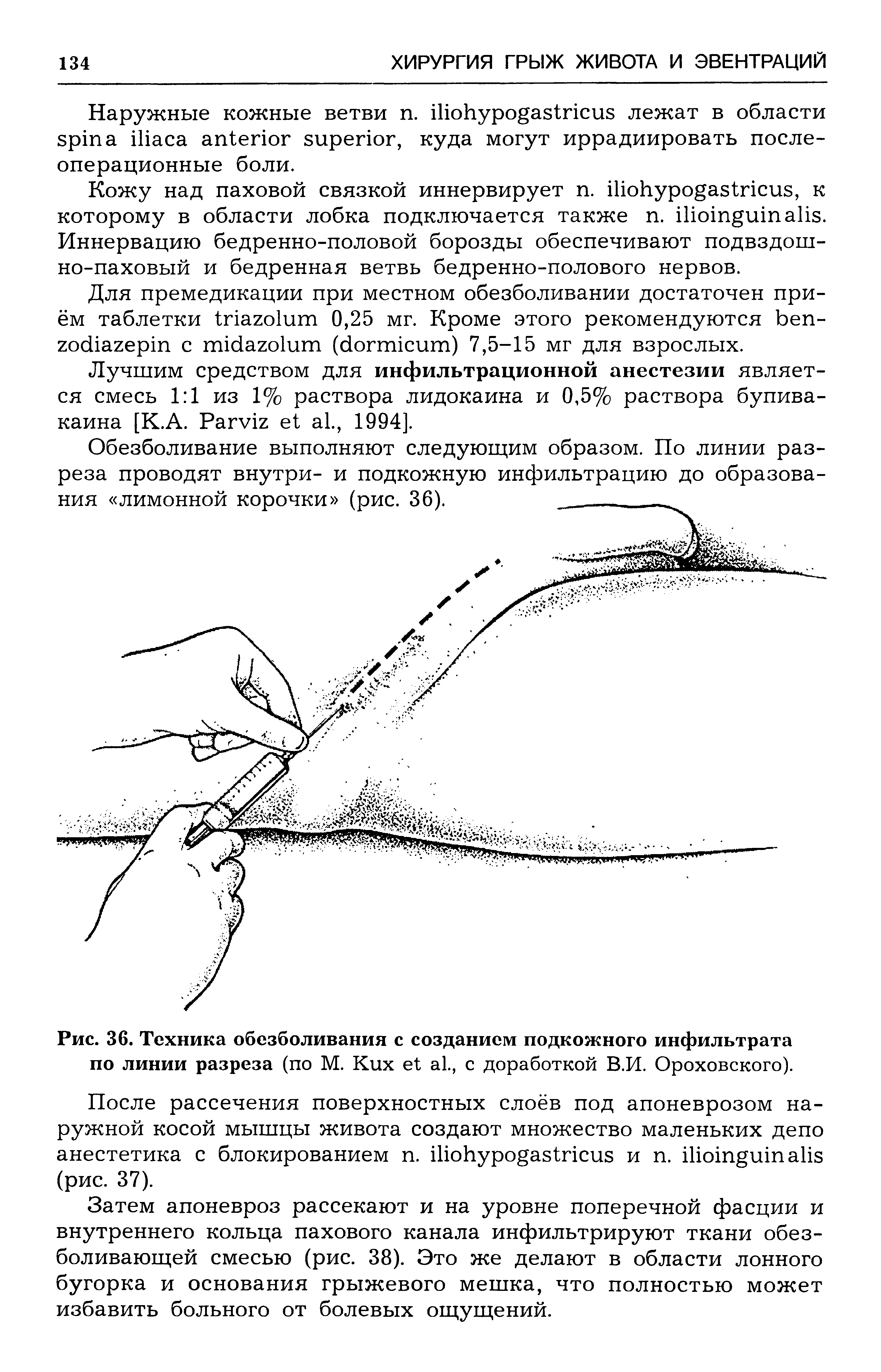 Рис. 36. Техника обезболивания с созданием подкожного инфильтрата по линии разреза (по М. K ., с доработкой В.И. Ороховского).