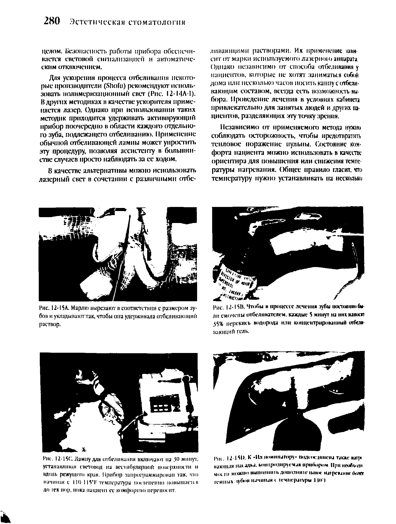 Рис. 12-15II. Чтобы н процессе лечения зубы постоянно были смочены отбелянателем. каждые минут на них наноси 35% перекись водорода или концентрироианный отбеливающий гель.