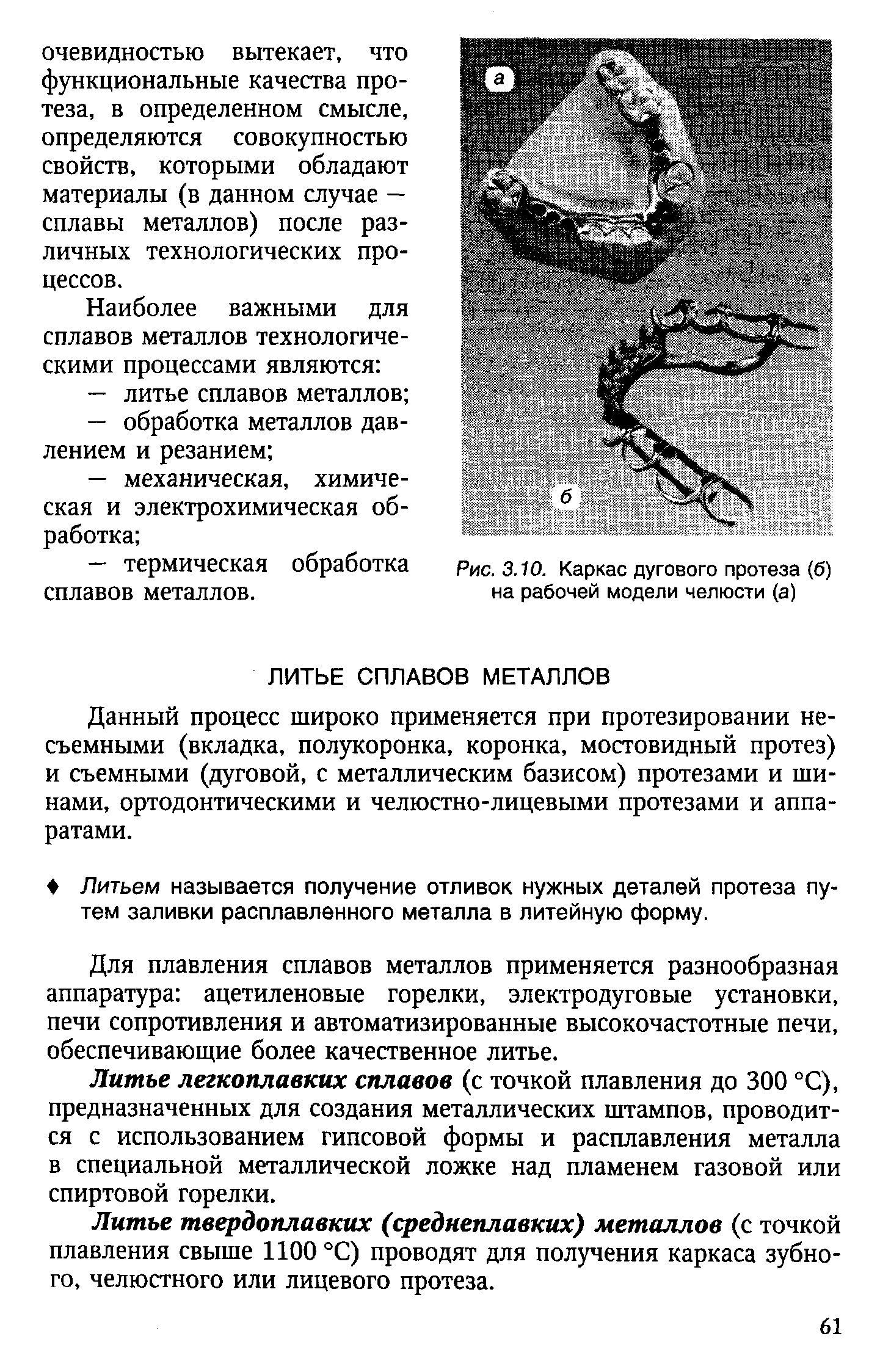 Рис. 3.10. Каркас дугового протеза (б) на рабочей модели челюсти (а)...