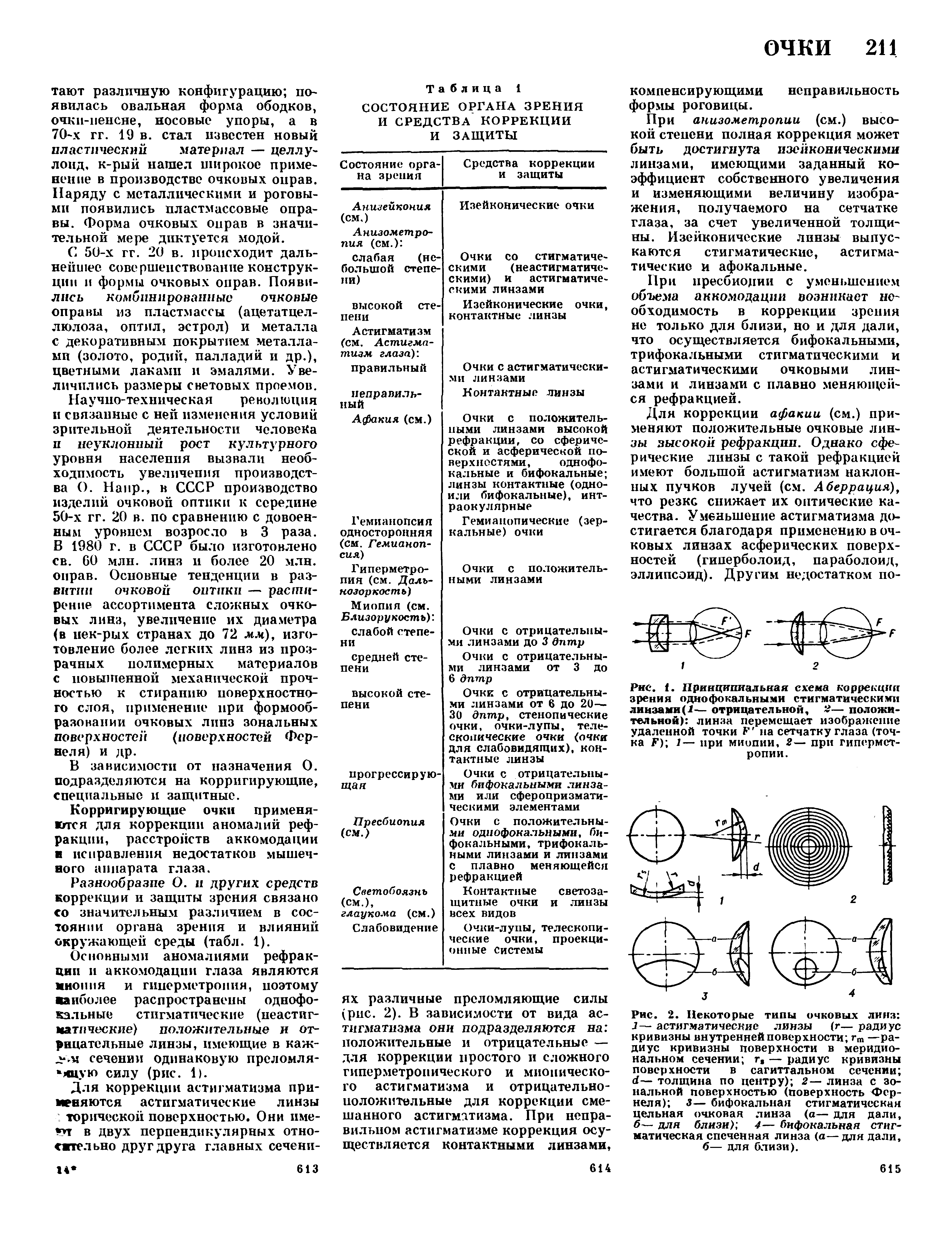 Рис. 1. Принципиальная схема коррекция зрения одно фокальными стигматическими линзами (2— отрицательной, 2— положительной) линза перемещает изображение удаленной точки Е на сетчатку глаза (точка Г) 1— при миопии, 2— при гиперметропии.