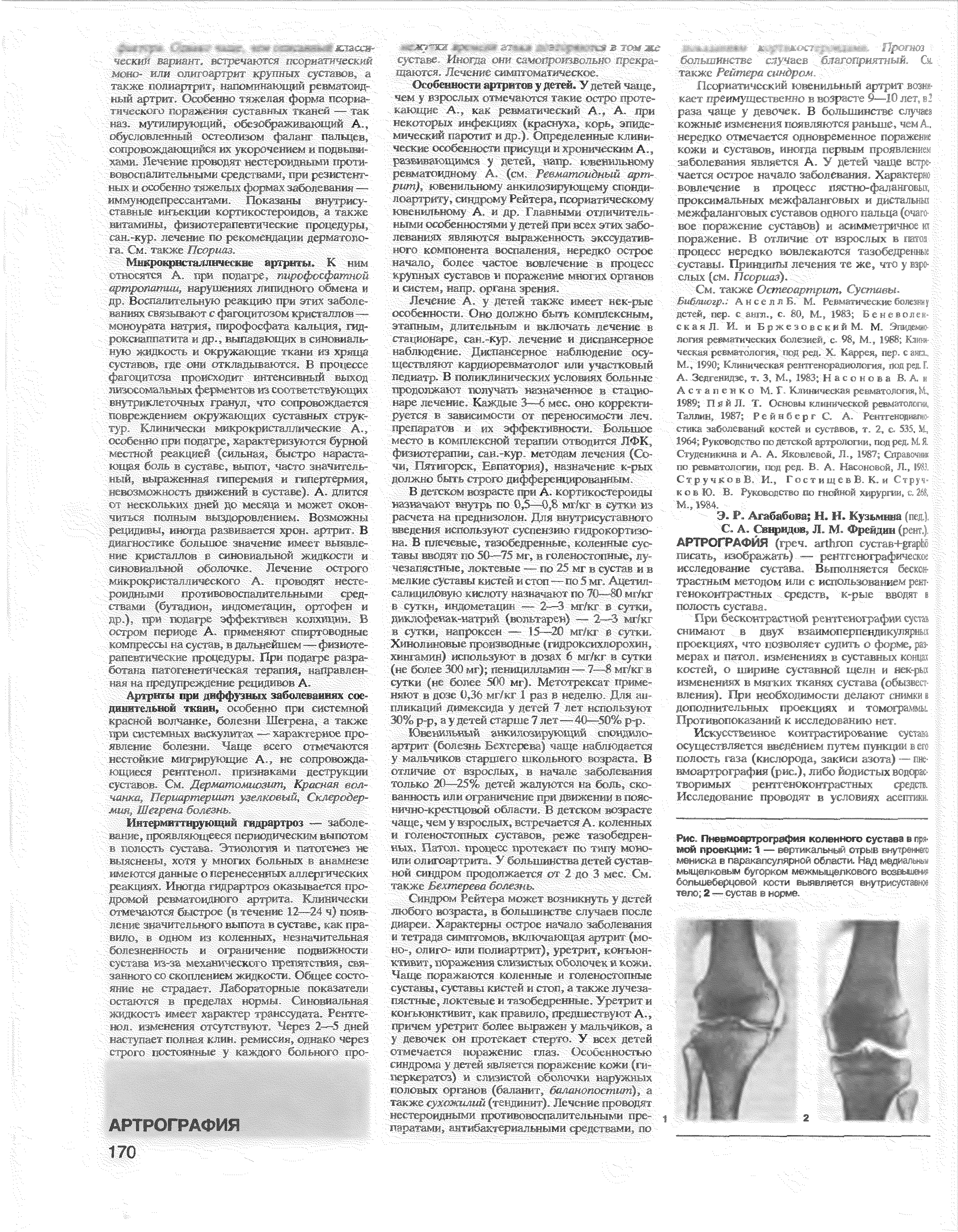 Рис. Пневмоартрография коленного сустав ь 1 мой проекции 1— вертикальный отрыв внутреннего мениска в паракапсулярной области. Над медиальный мыщелковым бугорком межмыщелкового I большеберцовой кости выявляется внутрисуставни тело 2— сустав в норме. > у...