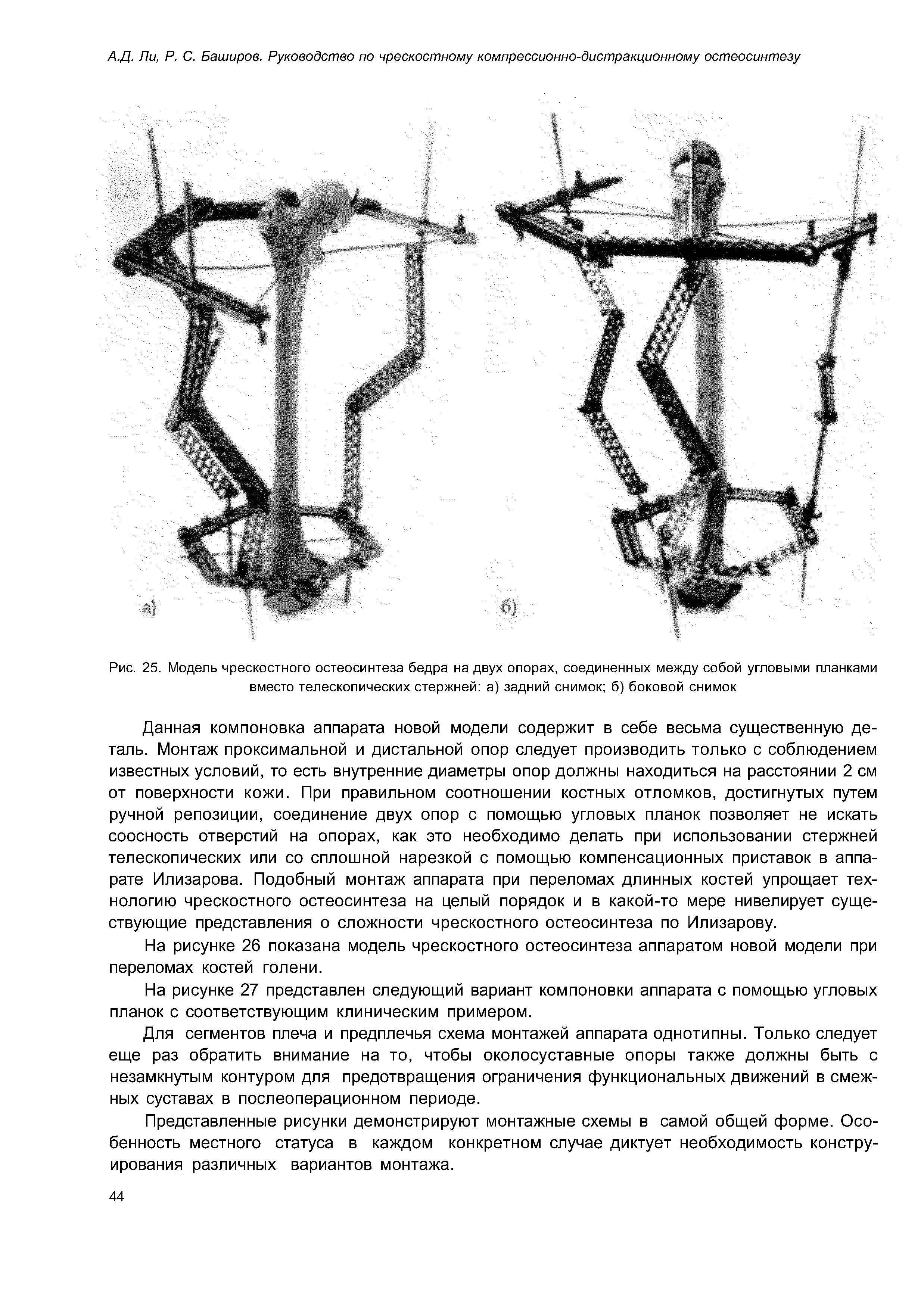 Рис. 25. Модель чрескостного остеосинтеза бедра на двух опорах, соединенных между собой угловыми планками вместо телескопических стержней а) задний снимок б) боковой снимок...