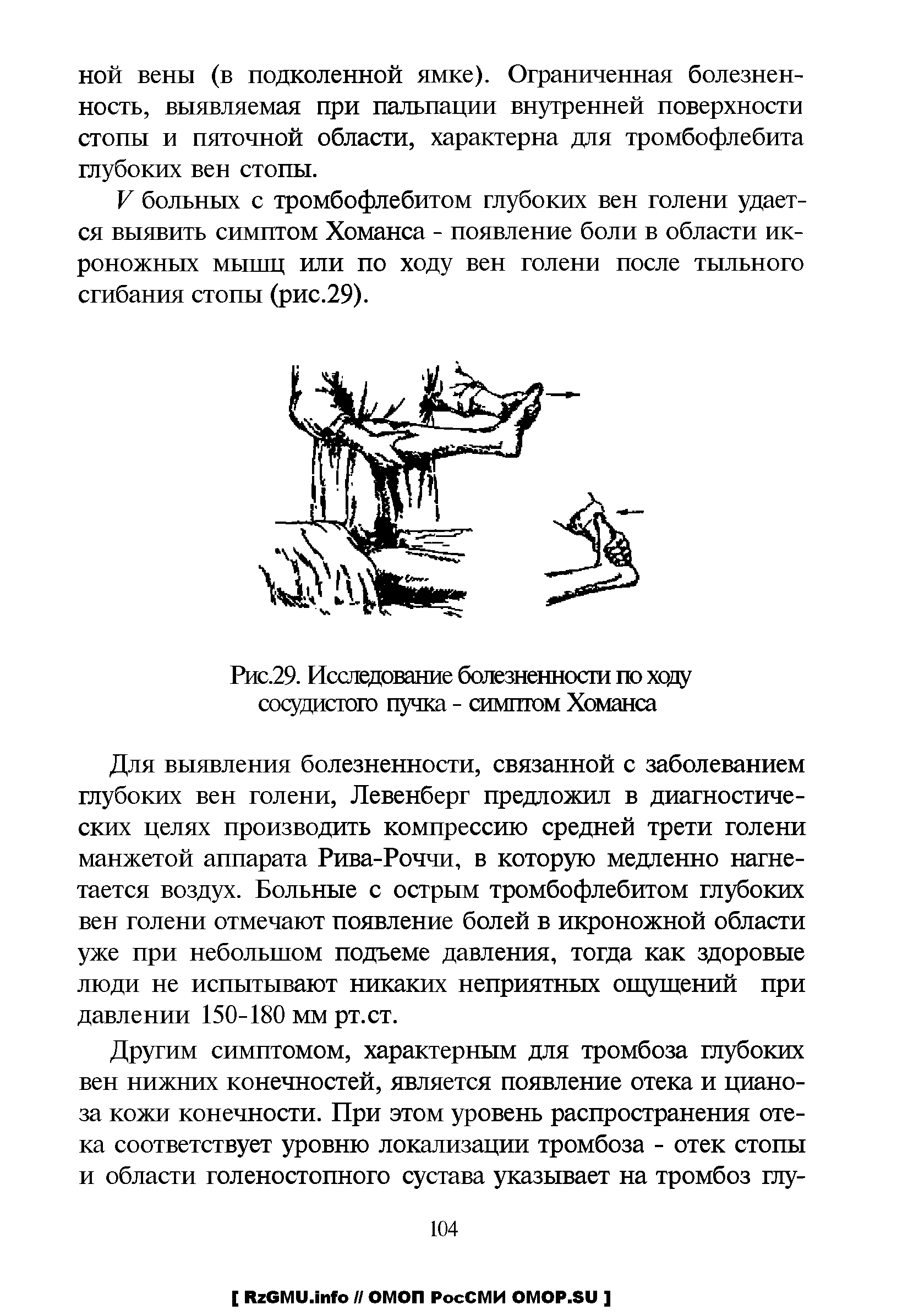 Рис.29. Исследование болезненности по ходу сосудистого пучка - симптом Хоманса...