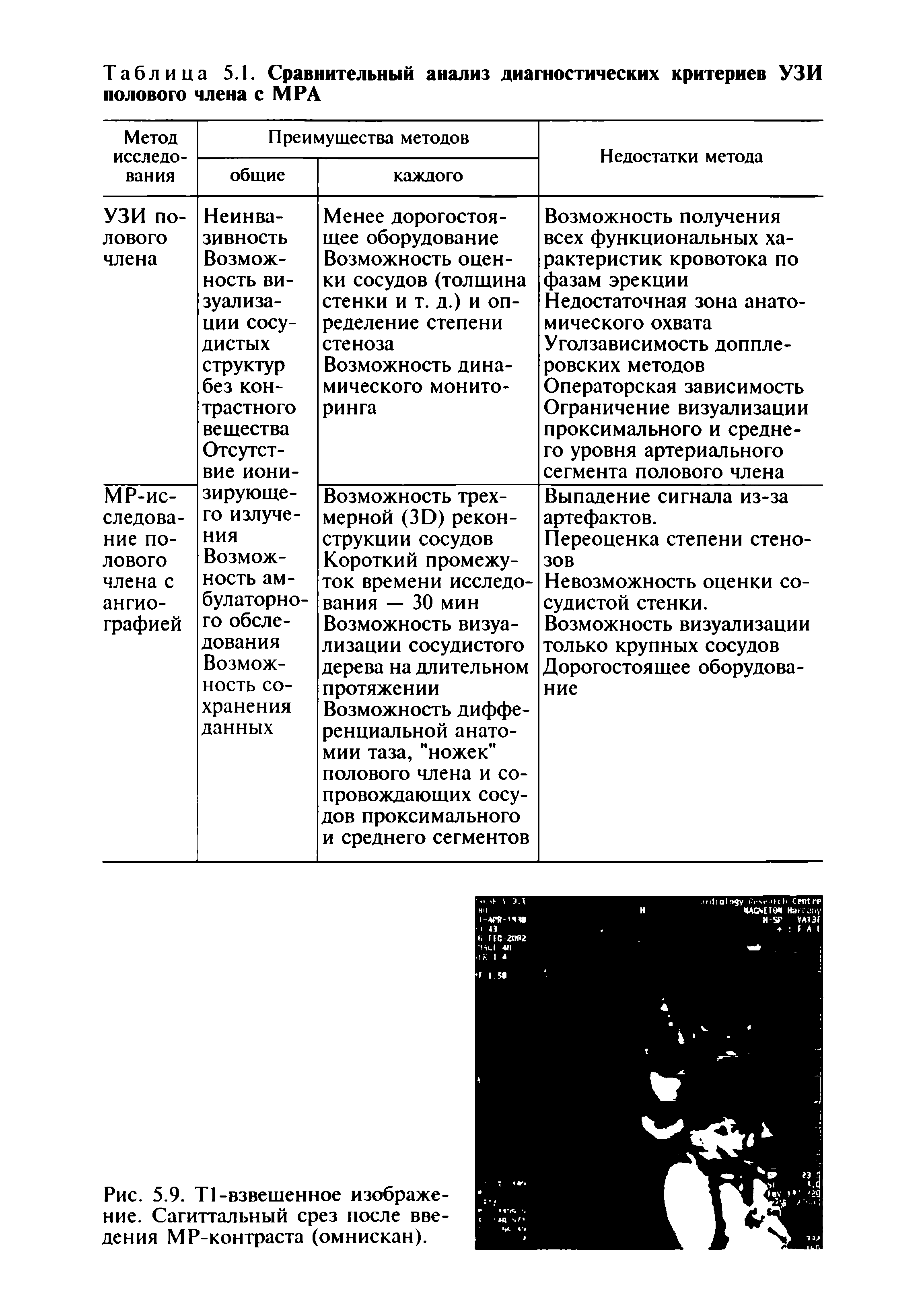 Рис. 5.9. Т1-взвешенное изображение. Сагиттальный срез после введения МР-контраста (омнискан).