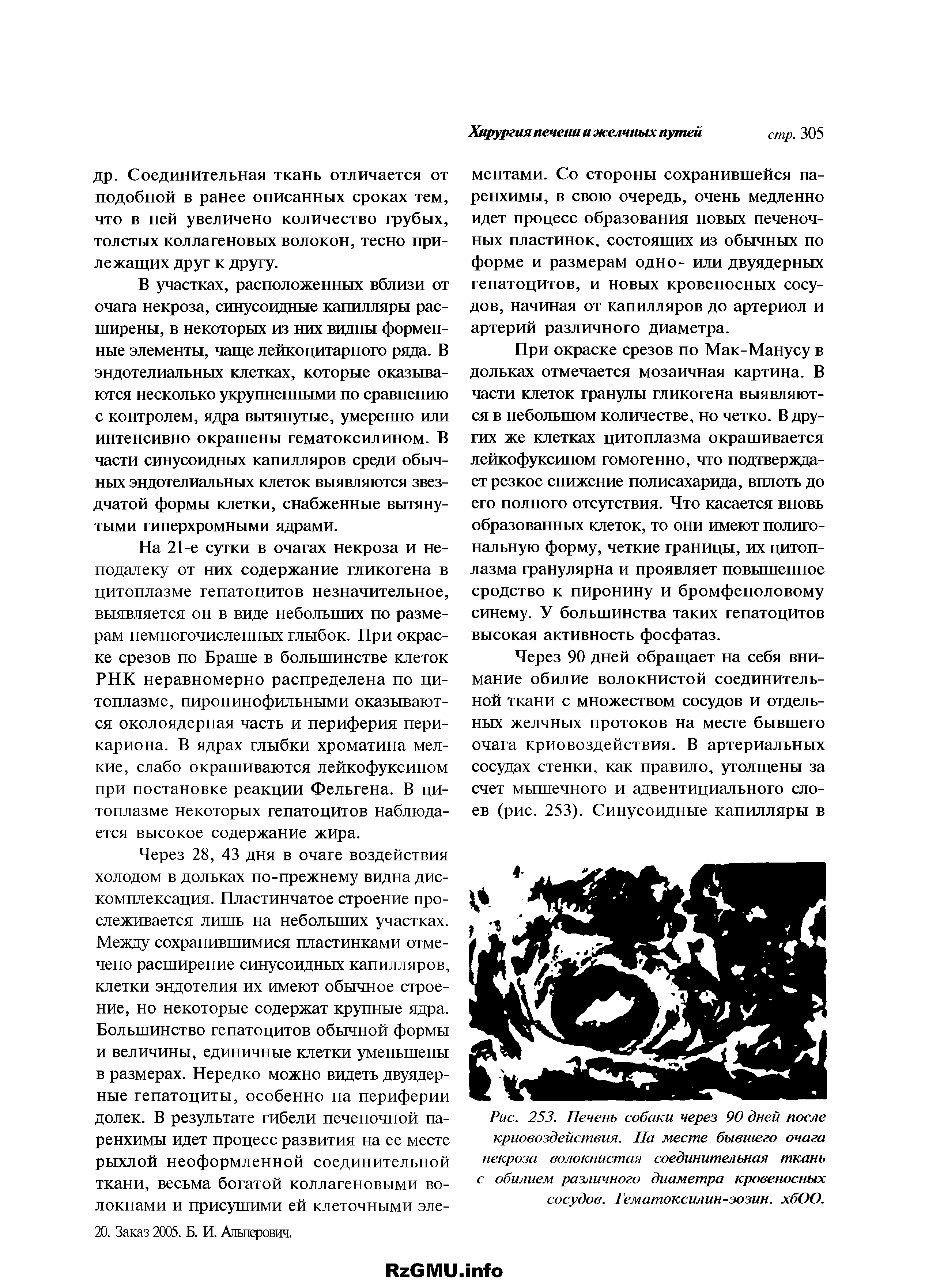 Рис. 253. Печень собаки через 90 дней после криовоздействия. На месте бывшего очага некроза волокнистая соединительная ткань с обилием различного диаметра кровеносных сосудов. Гематоксилин-эозин. хбОО.