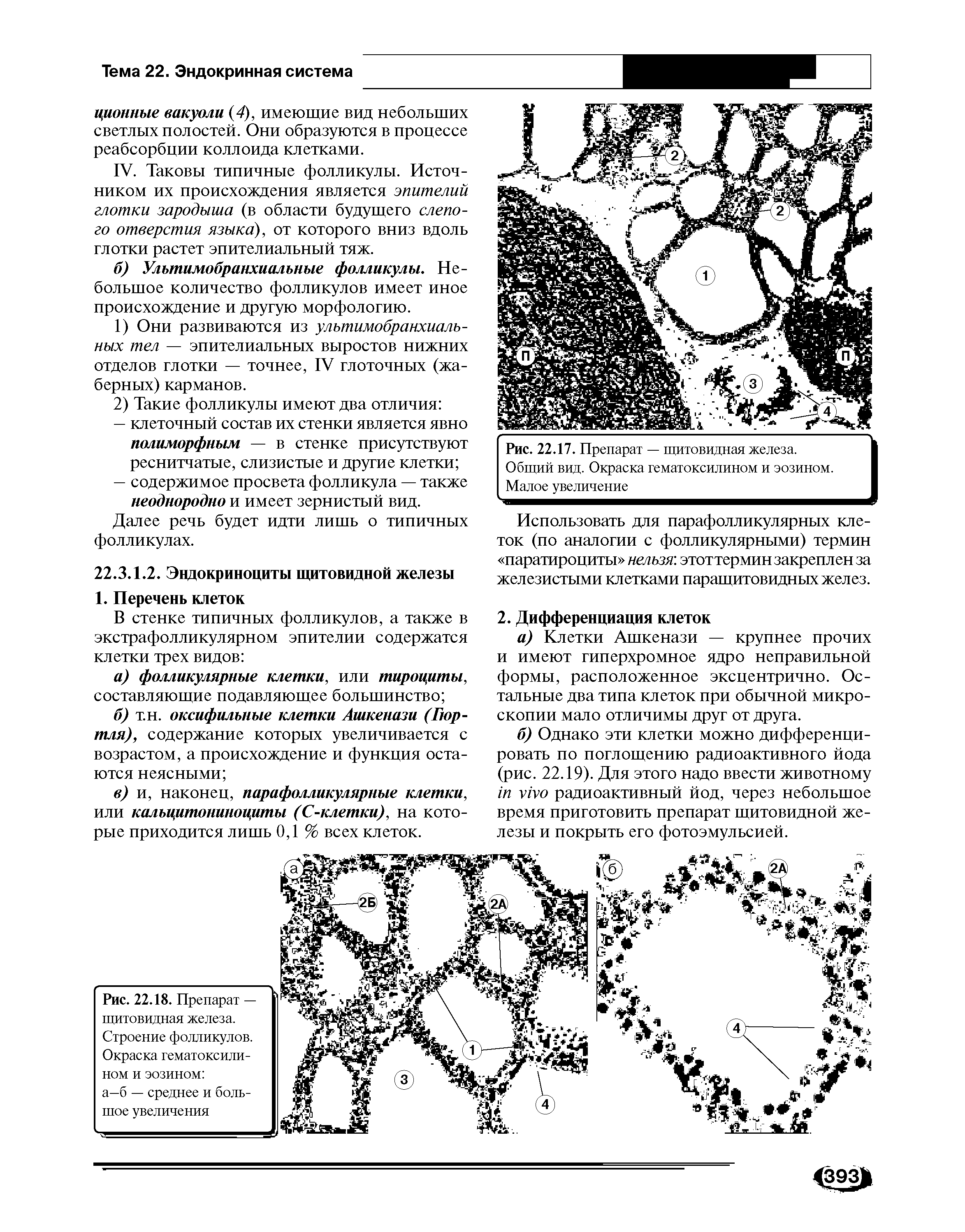 Рис. 22.18. Препарат — щитовидная железа. Строение фолликулов. Окраска гематоксилином и эозином а—б — среднее и большое увеличения...