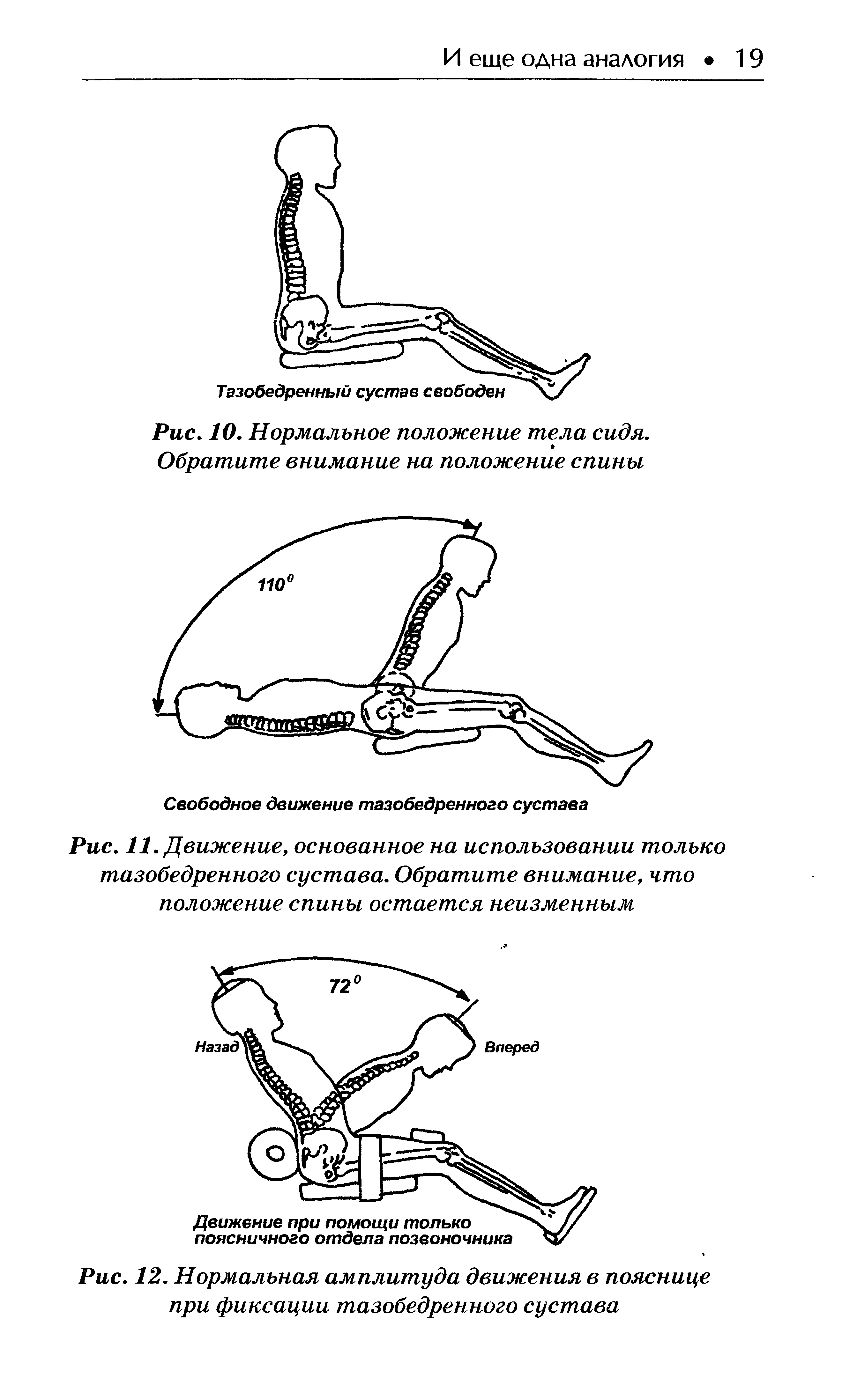 Рис. 12. Нормальная амплитуда движения в пояснице при фиксации тазобедренного сустава...