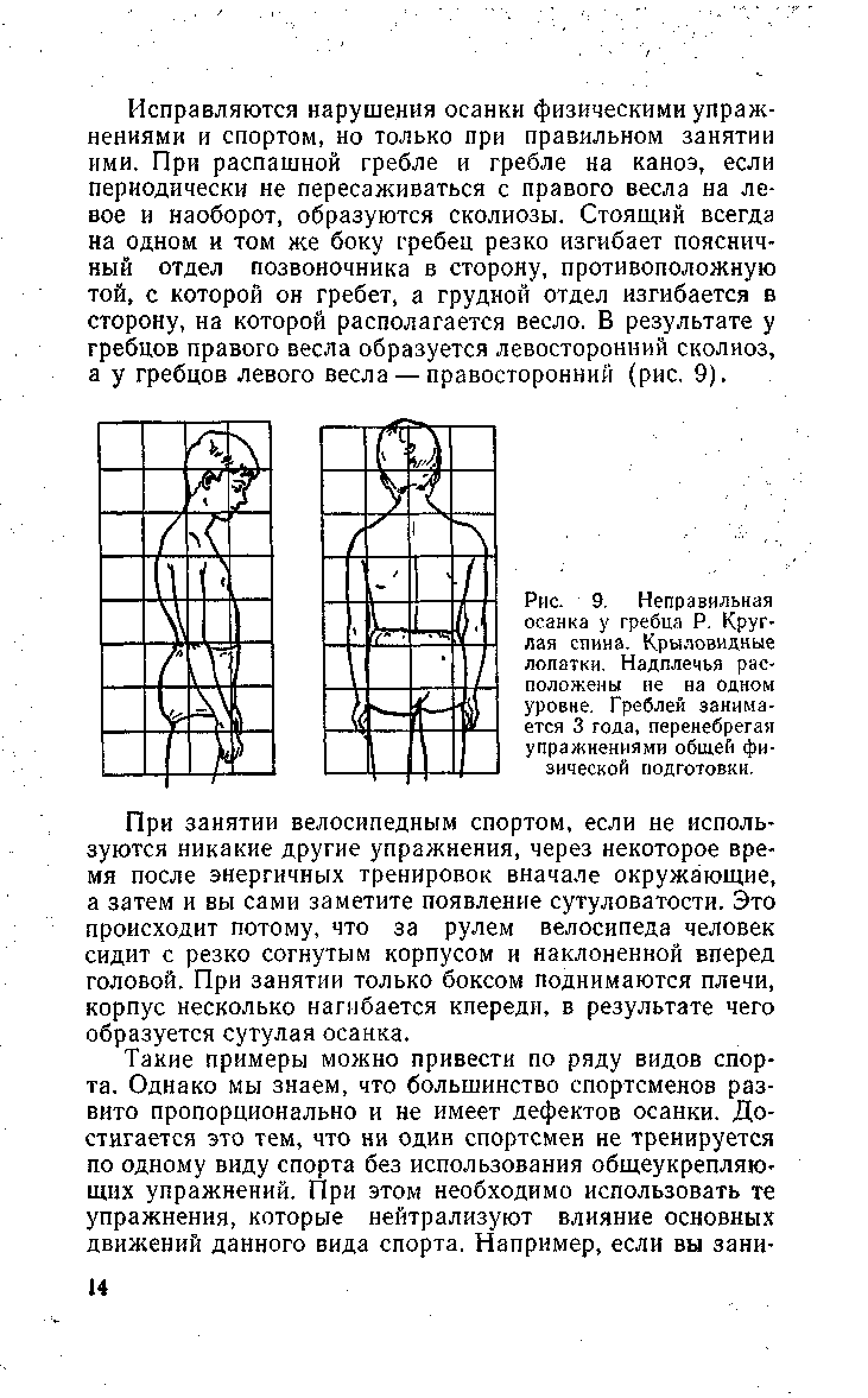 Рис. 9. Неправильная осанка у гребца Р. Круглая спина. Крыловидные лопатки. Надплечья расположены не на одном уровне. Греблей занимается 3 года, перенебрегая упражнениями общей физической подготовки.