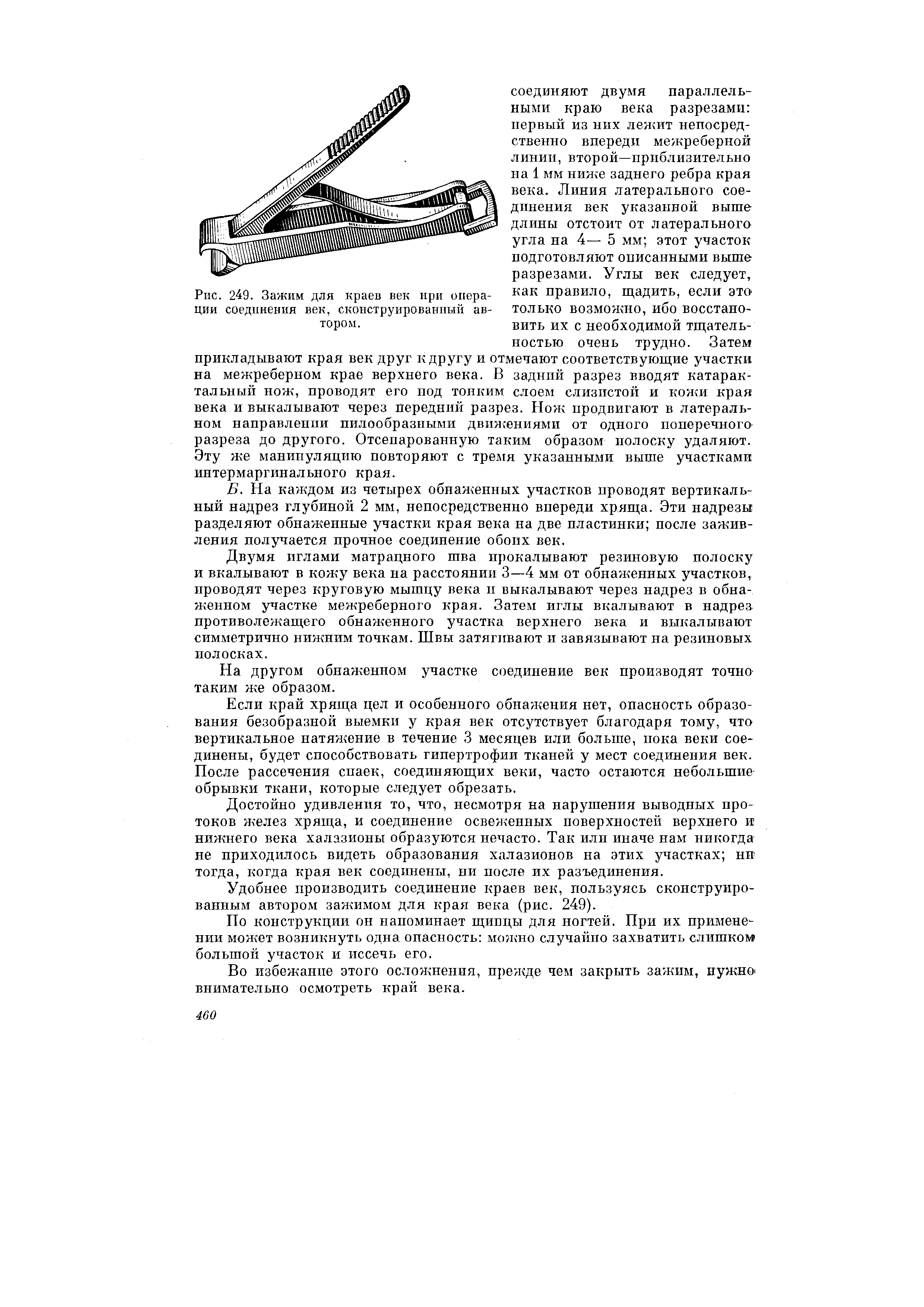 Рис. 249. Зажим для краев век при опера- как правило, щадить, если это ции соединения век, сконструированный ав- только возможно, ибо восстано-ТОРОМ- вить их с необходимой тщатель-...
