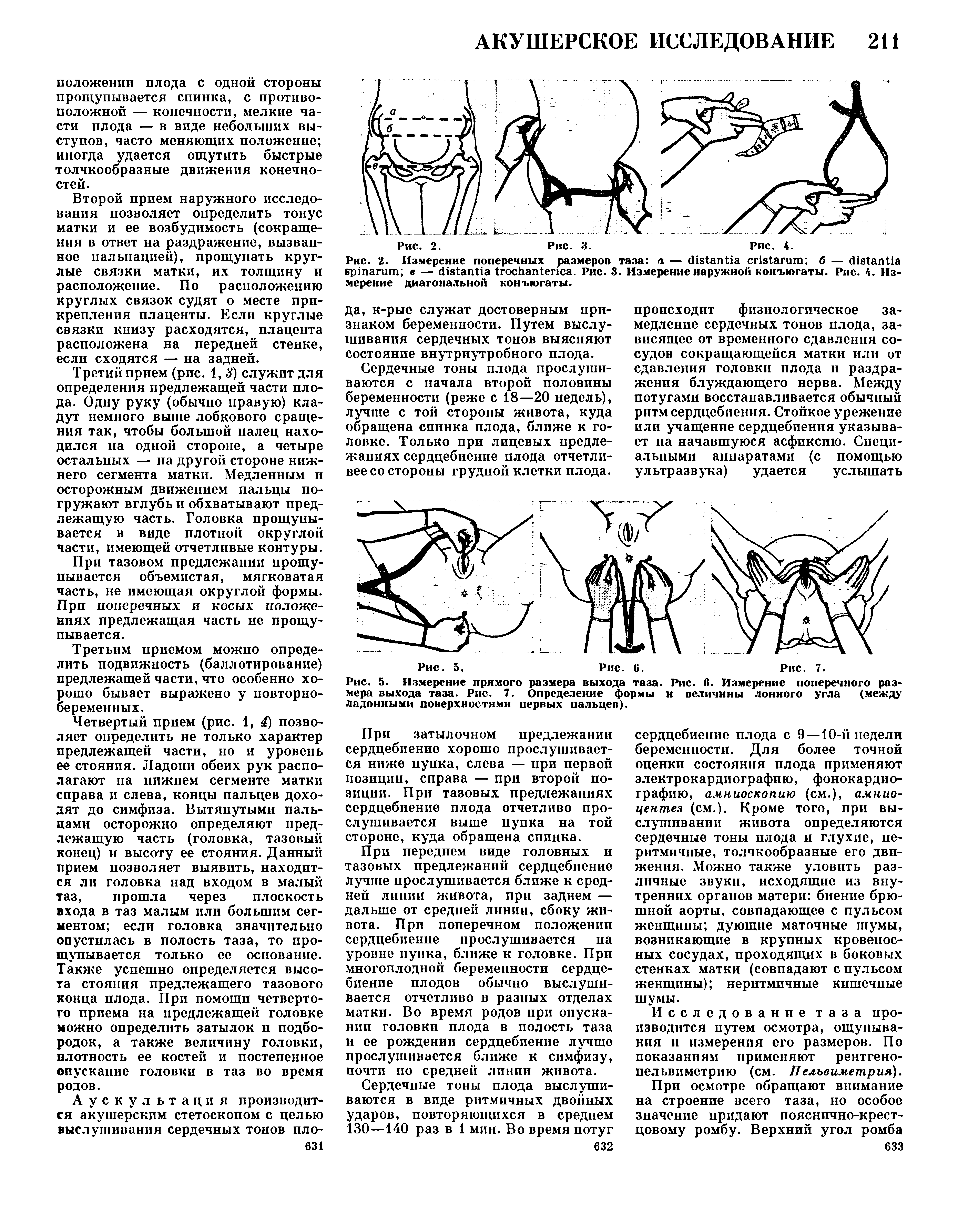 Рис. 5. Измерение прямого размера выхода таза. Рис. 6. Измерение поперечного размера выхода таза. Рис. 7. Определение формы и величины лонного угла (между Ладонными поверхностями первых пальцев).