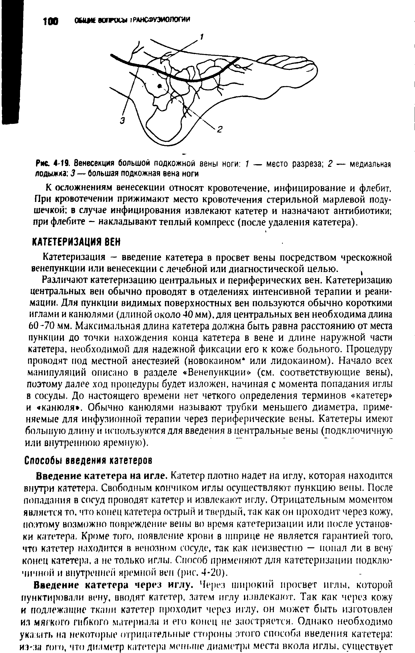 Рис. 4-19. Венесекция большой подкожной вены ноги 1 — место разреза 2 — медиальная лодыжка 3 — большая подкожная вена ноги...