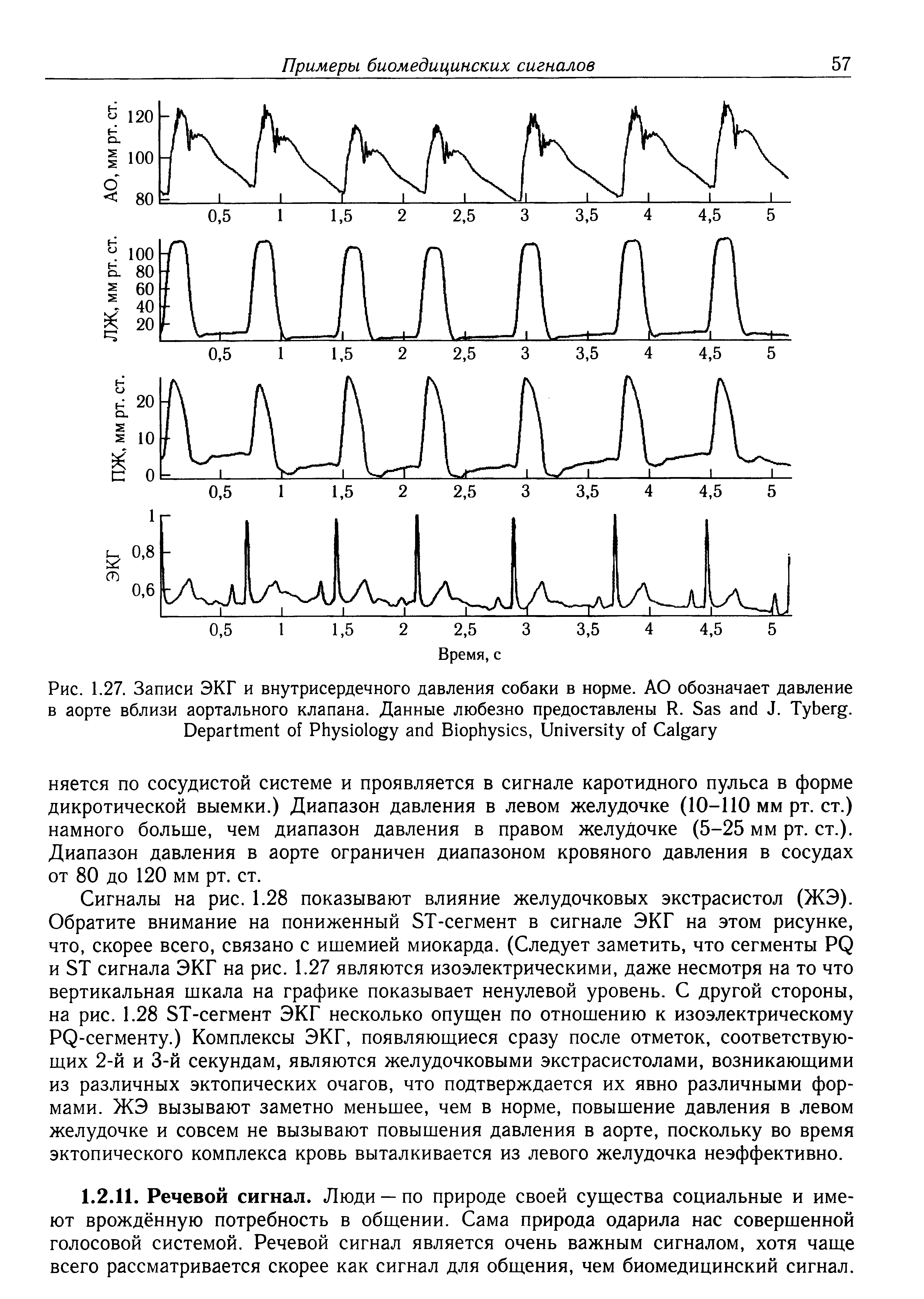 Рис. 1.27. Записи ЭКГ и внутрисердечного давления собаки в норме. АО обозначает давление в аорте вблизи аортального клапана. Данные любезно предоставлены R. S J. T . D P B , U C ...