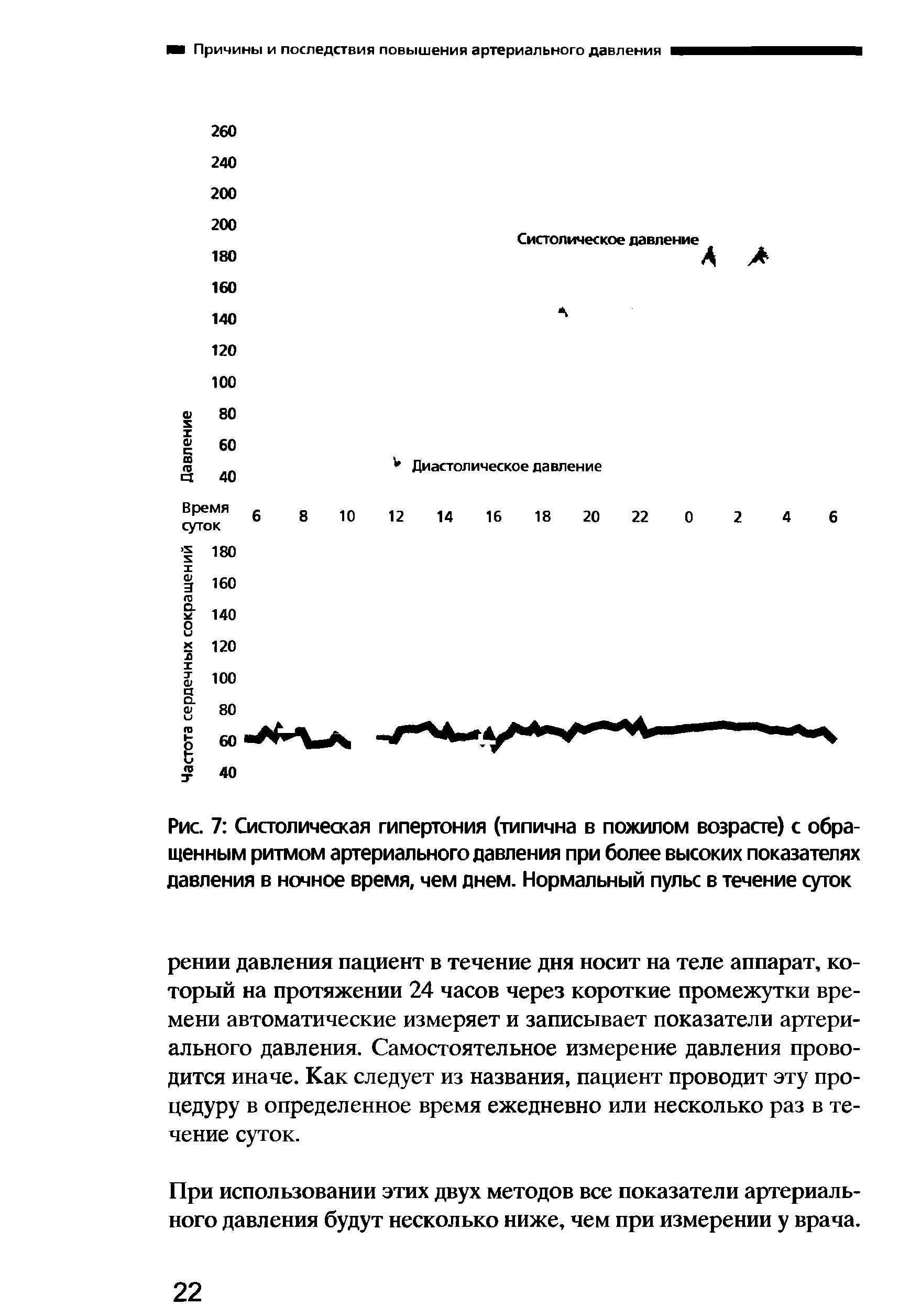 Рис. 7 Систолическая гипертония (типична в пожилом возрасте) с обращенным ритмом артериального давления при более высоких показателях давления в ночное время, чем днем. Нормальный пульс в течение суток...