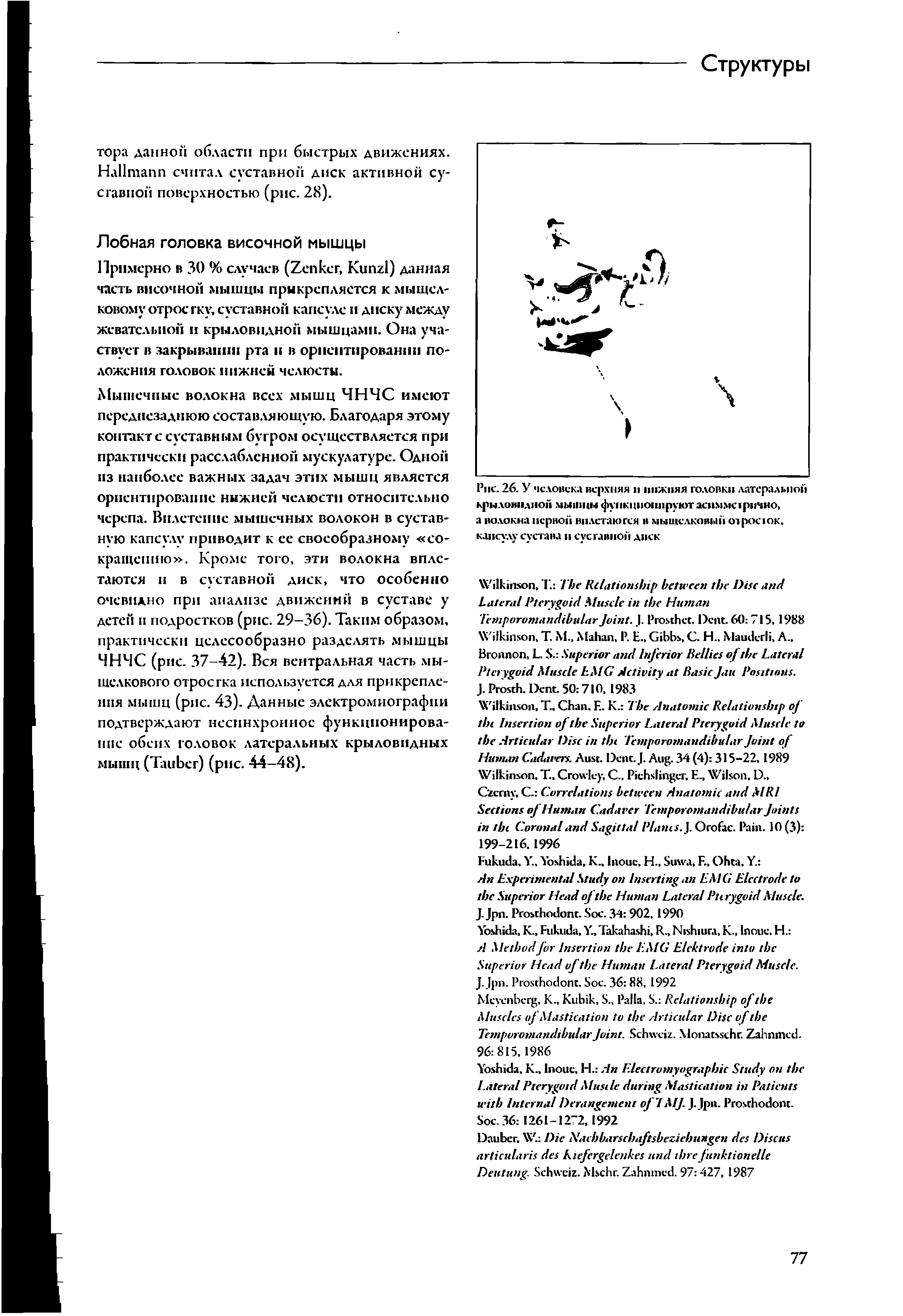 Рис. 26. У человека верхняя и ппжпяя головки латеральной крыловидной мышцы функционируют M HO, а волокна первой вплетаются в мыщелковый отросюк. капсулу сустава и суставной диск...