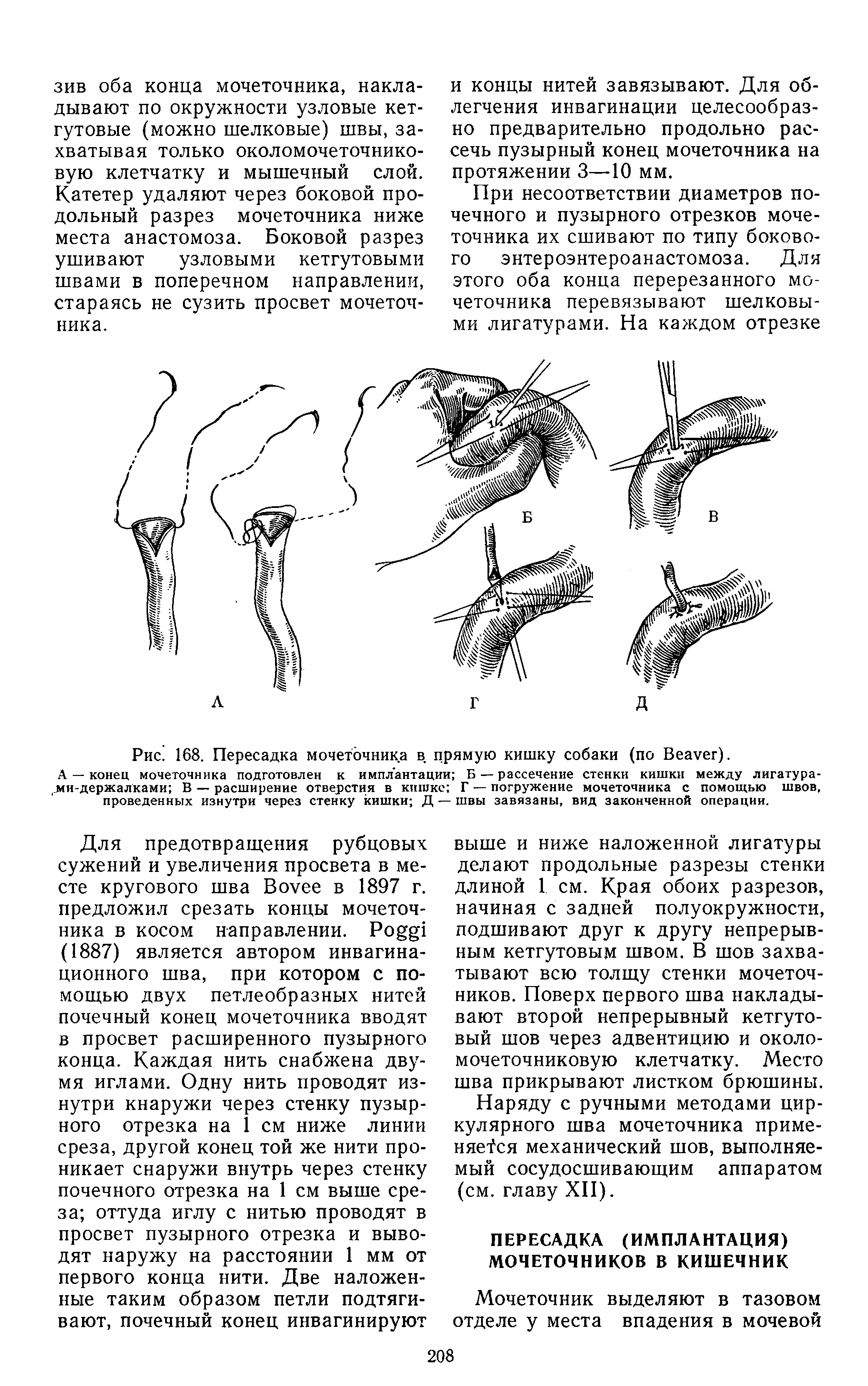 Рис. 168. Пересадка мочеточника в прямую кишку собаки (по B ).