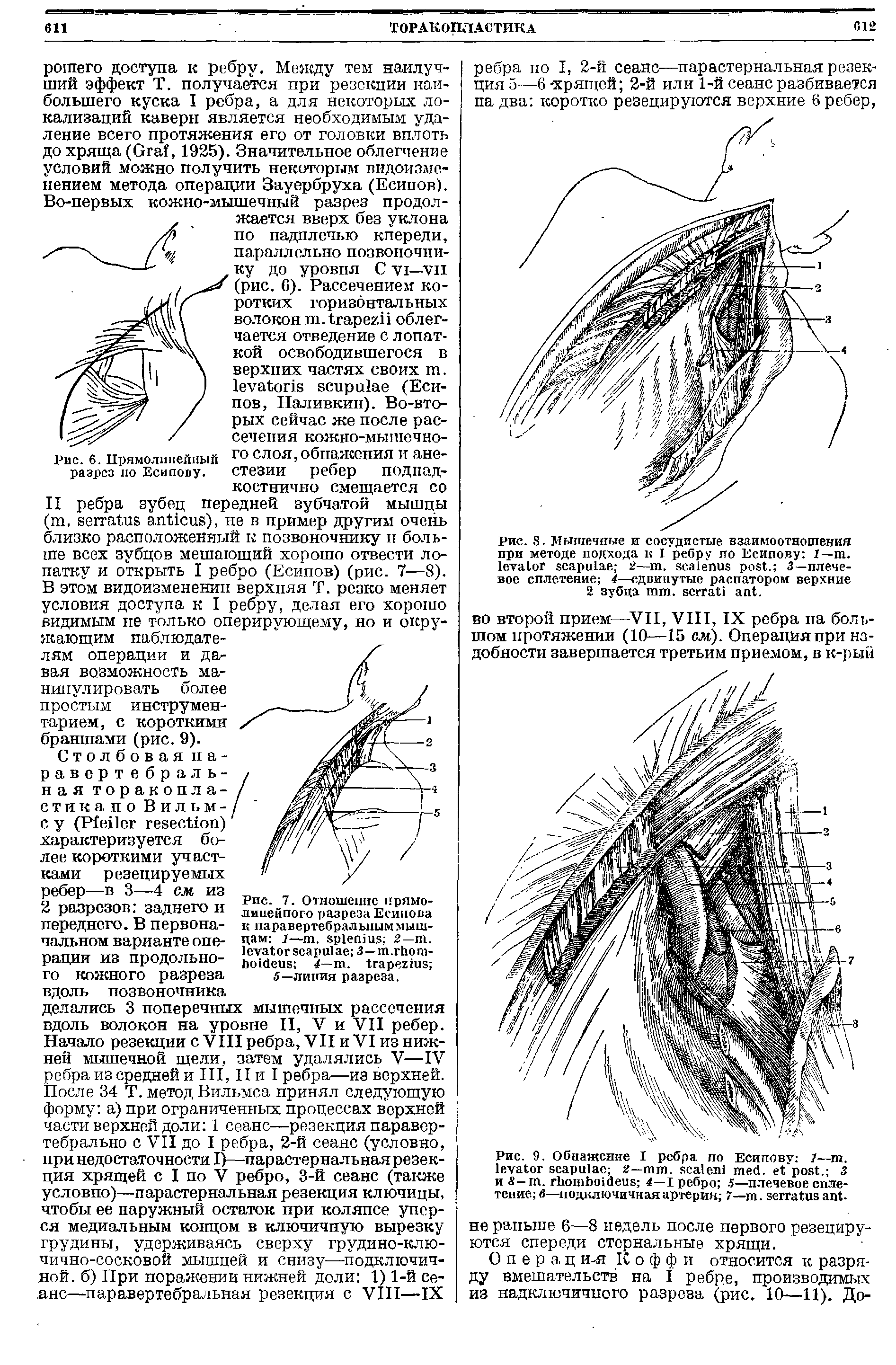 Рис. 9. Обнажение I ребра по Есипову 1—т. 2— . . . 3 и 8— . 4—I ребро . 5—плечевое сплетение —подключичная артерия 7— . .