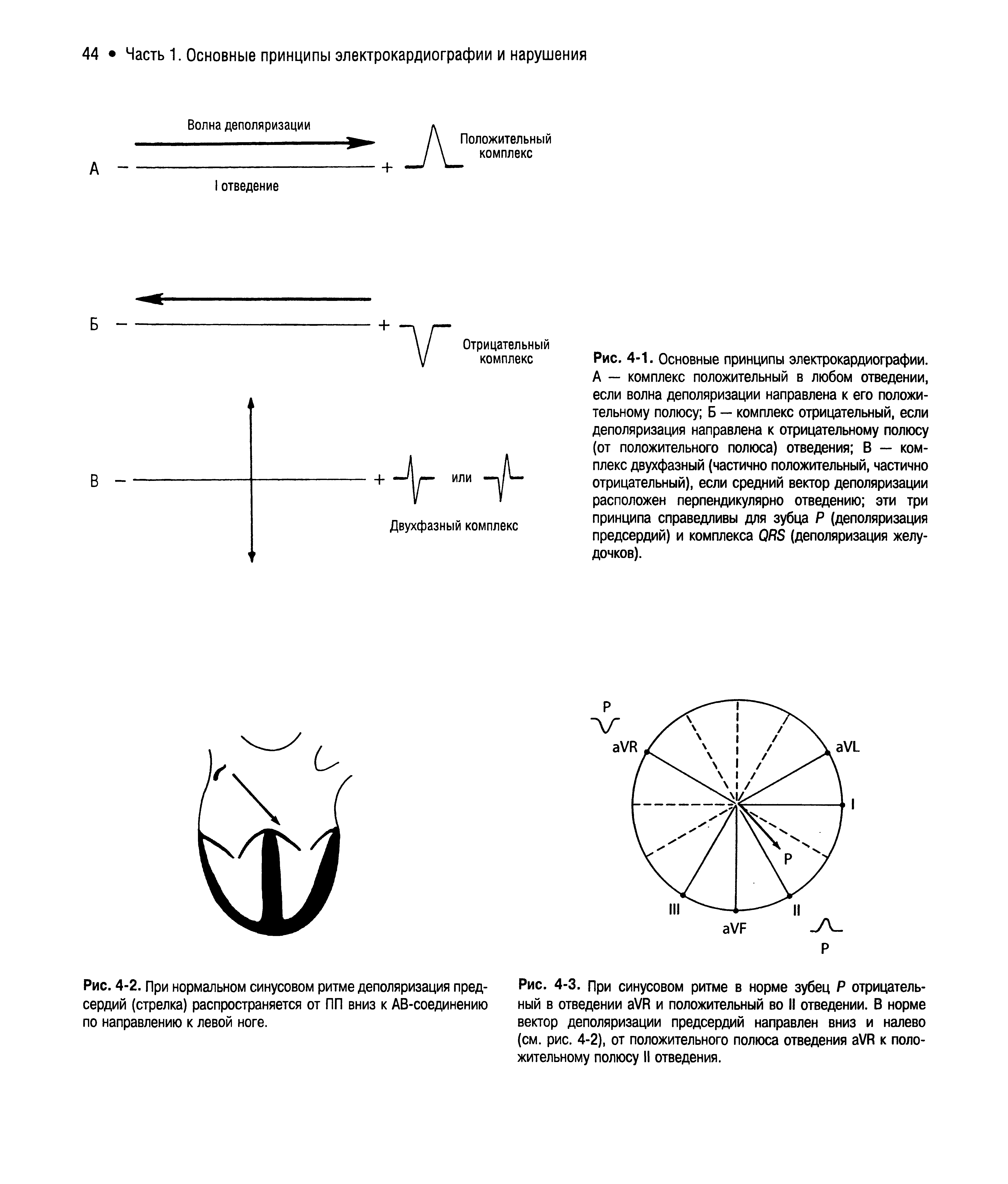 Рис. 4-2. При нормальном синусовом ритме деполяризация предсердий (стрелка) распространяется от ПП вниз к АВ-соединению по направлению к левой ноге.