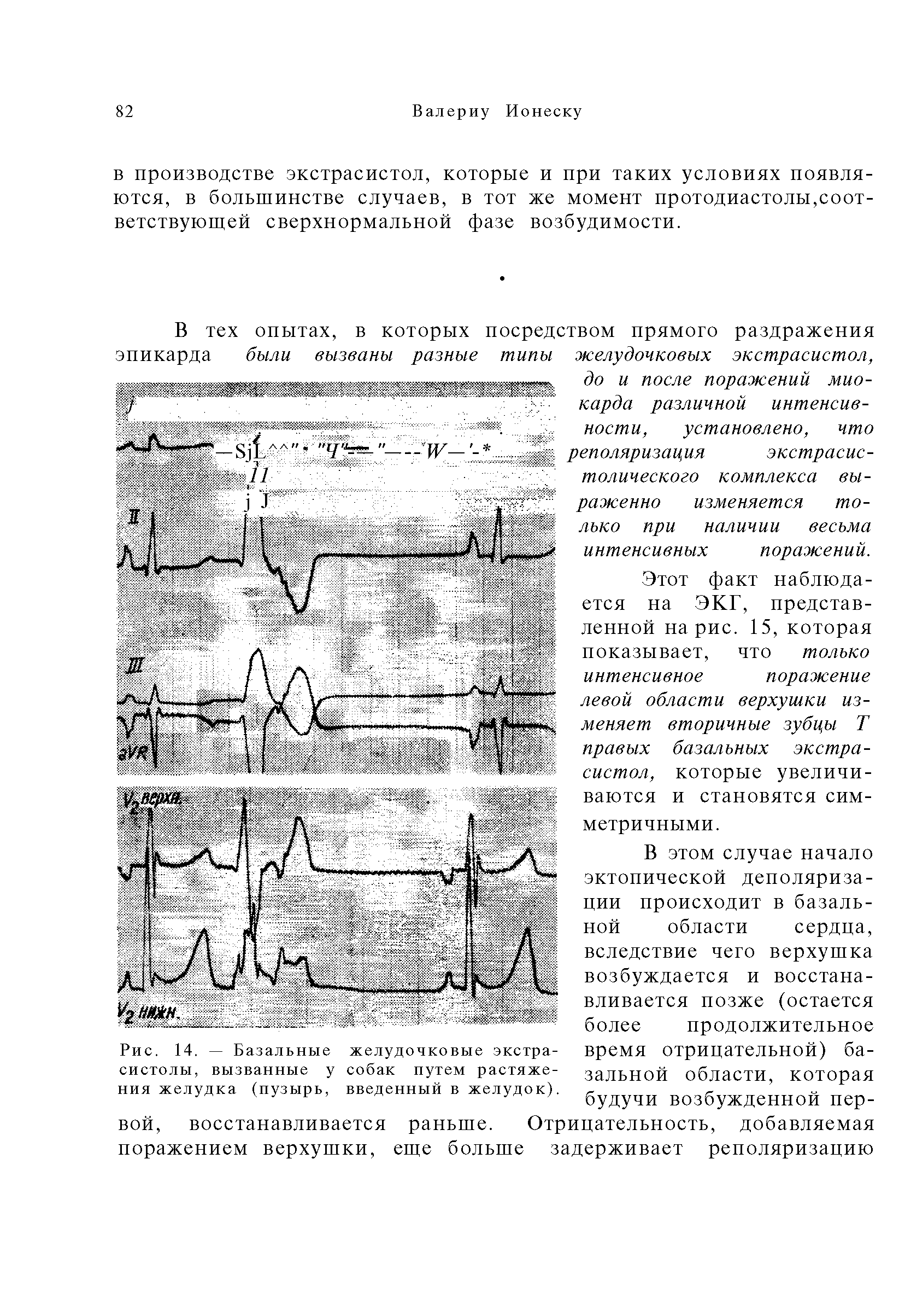 Рис. 14. — Базальные желудочковые экстрасистолы, вызванные у собак путем растяжения желудка (пузырь, введенный в желудок).