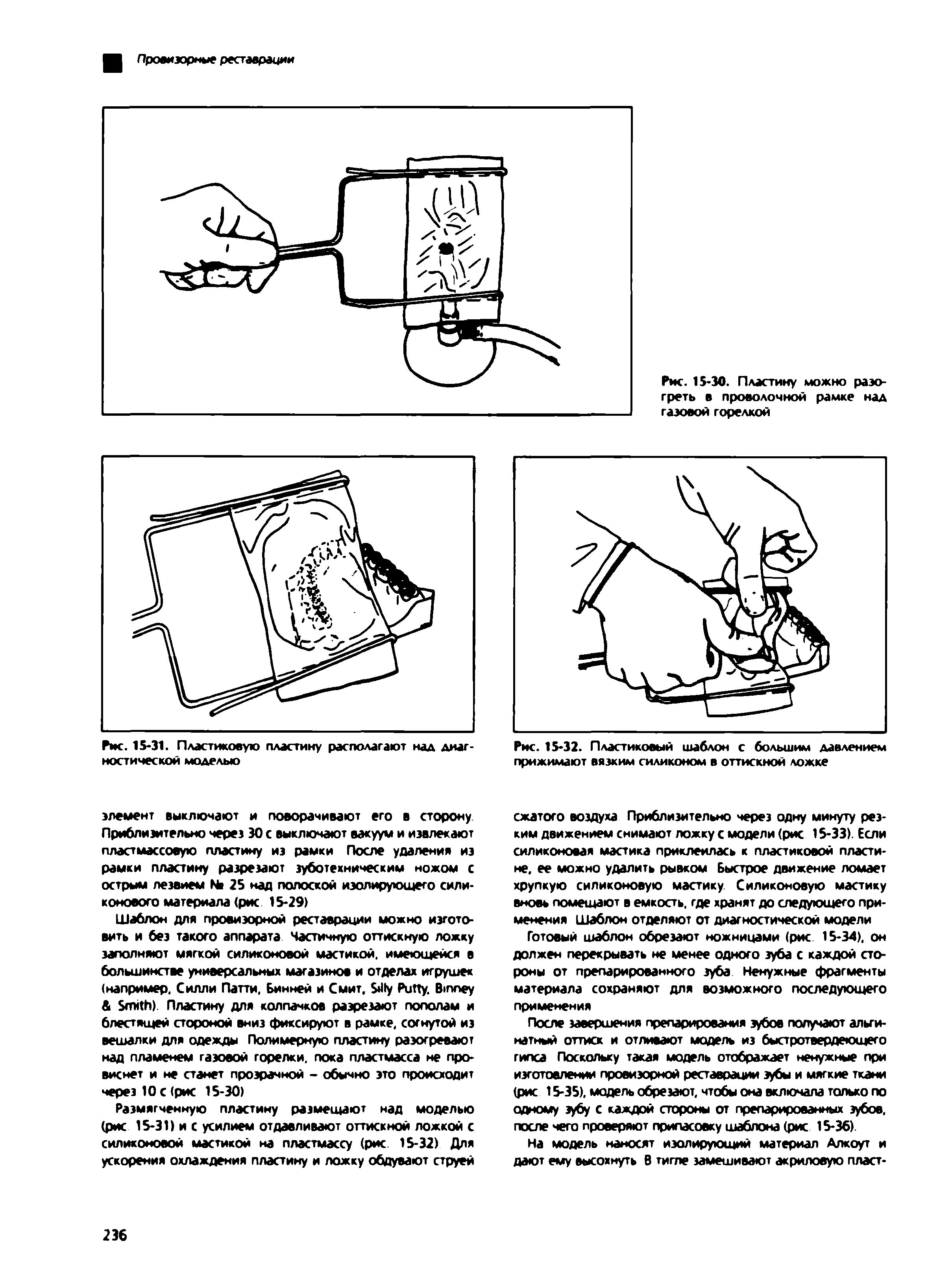 Рис. 15-32. Пластиковый шаблон с большим давлением прижимают вязким силиконом в оттискной ложке...