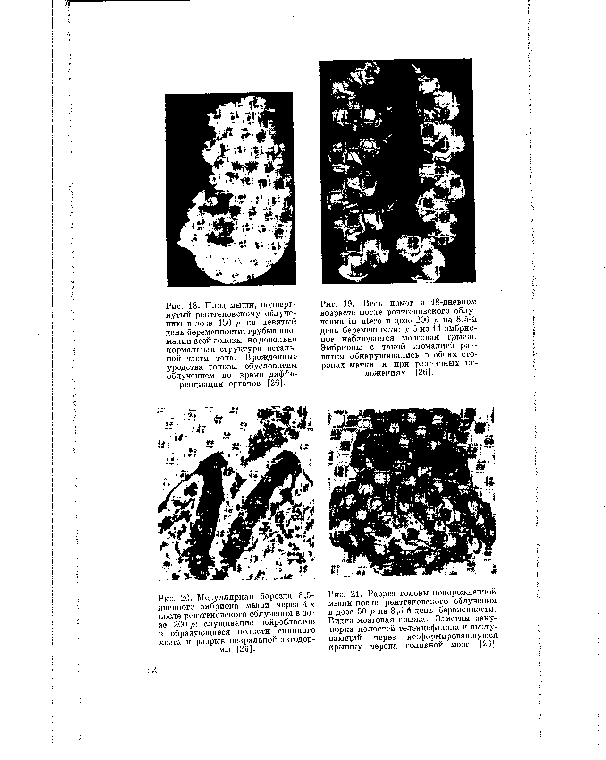 Рис. 20. Медуллярная борозда 8,5-дневпого эмбриона мыши через 4 ч после рентгеновского облучения в дозе 200 р-, слущивание нейробласгов в образующиеся полости спинного мозга и разрыв невральной эктодермы [26].