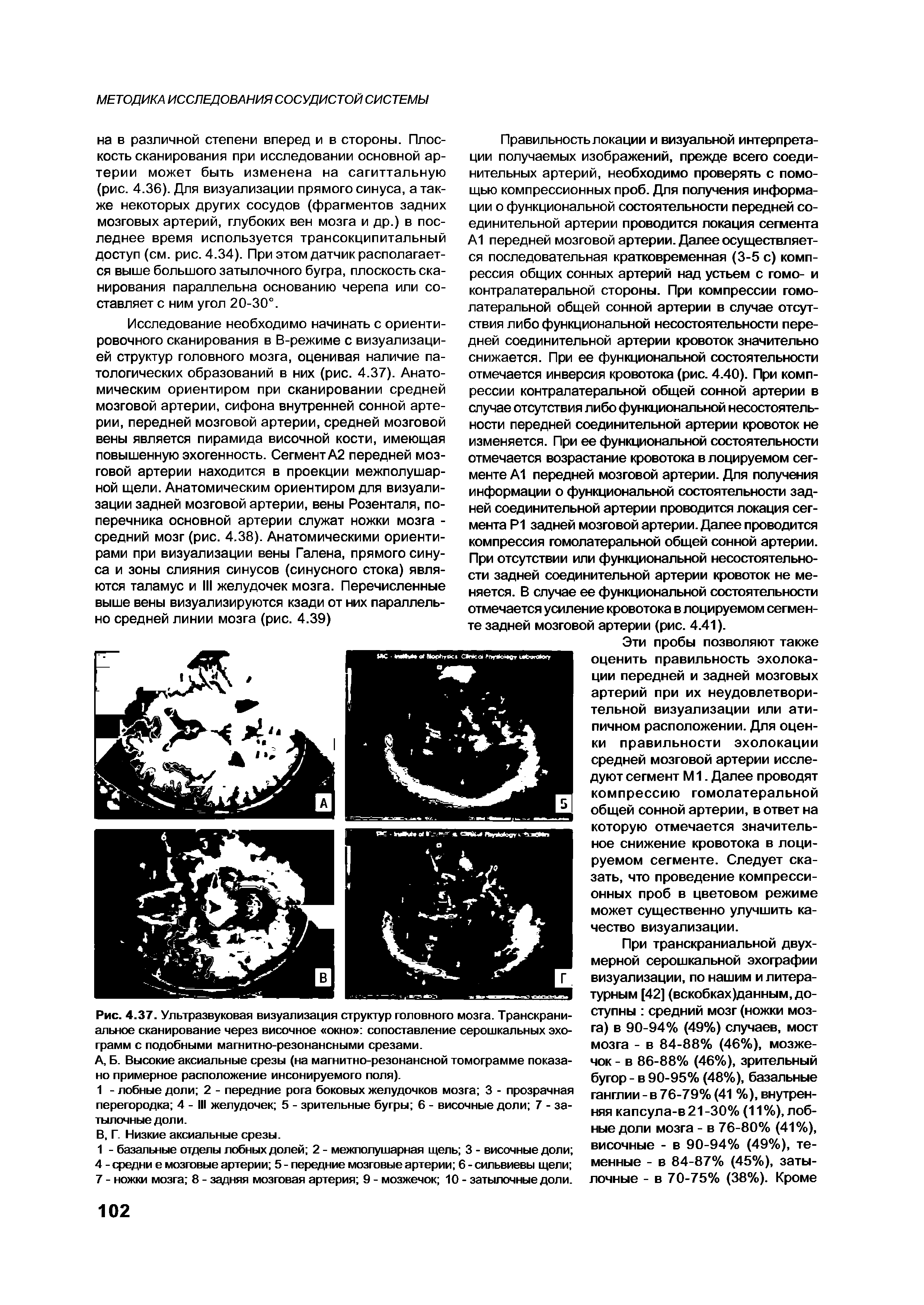 Рис. 4.37. Ультразвуковая визуализация структур головного мозга. Транскраниальное сканирование через височное окно сопоставление серошкальных эхо-грамм с подобными магнитно-резонансными срезами.