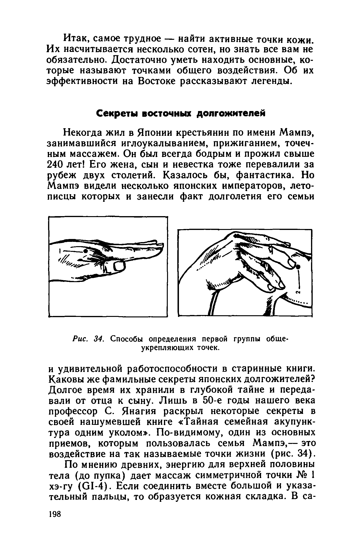 Рис. 34. Способы определения первой группы общеукрепляющих точек.