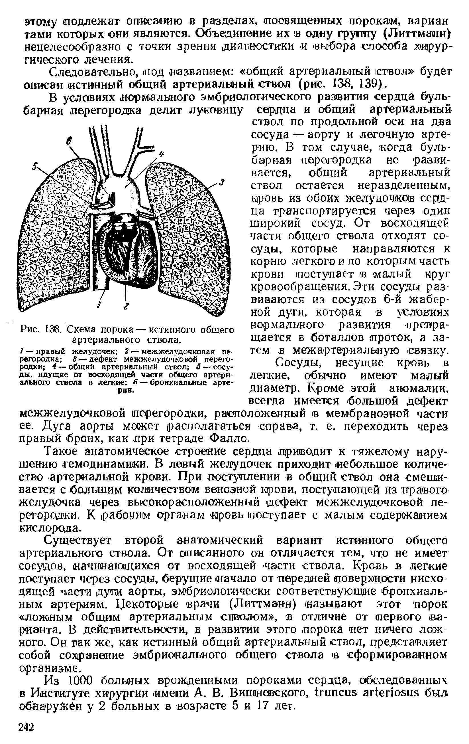 Рис. 138. Схема порока — истинного общего артериального ствола.