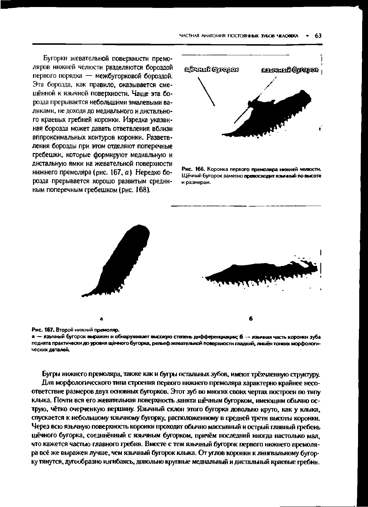 Рис. 166. Коронка первого гремоляра нижней чепосги. Щёчный бугорок заметно превосходит язычный по высоте и размерам.