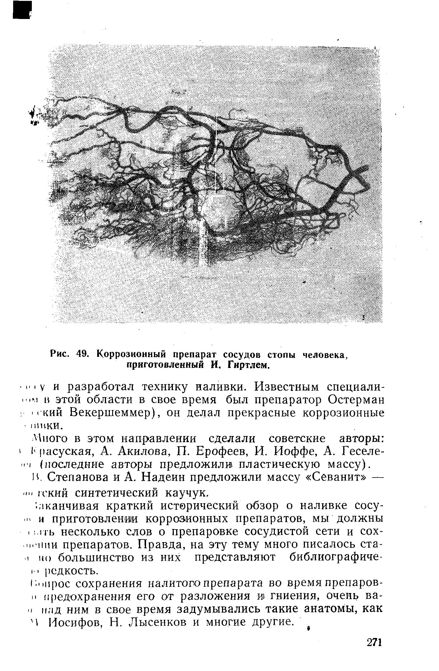 Рис. 49. Коррозионный препарат сосудов стопы человека, приготовленный И. Гиртлем.