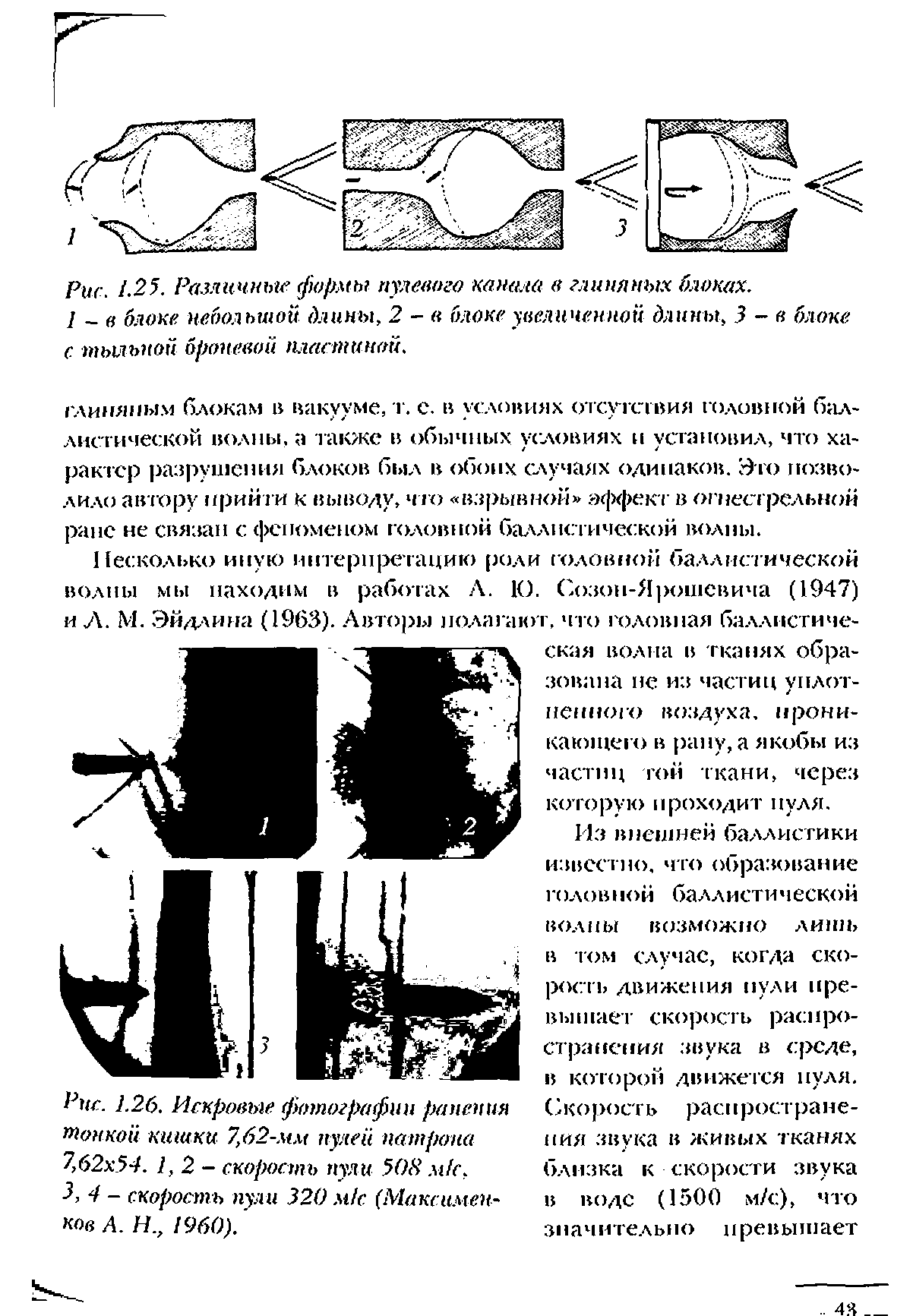 Рис. 1.26. Искровые фотографии ранения тонкой кишки 7,62-мм пулей патрона 7,62 54. 1,2- скорость нул и 508 мк, 3,4 - скорость пули 320 м/с (Макс имен-ков А. Н., 1960).