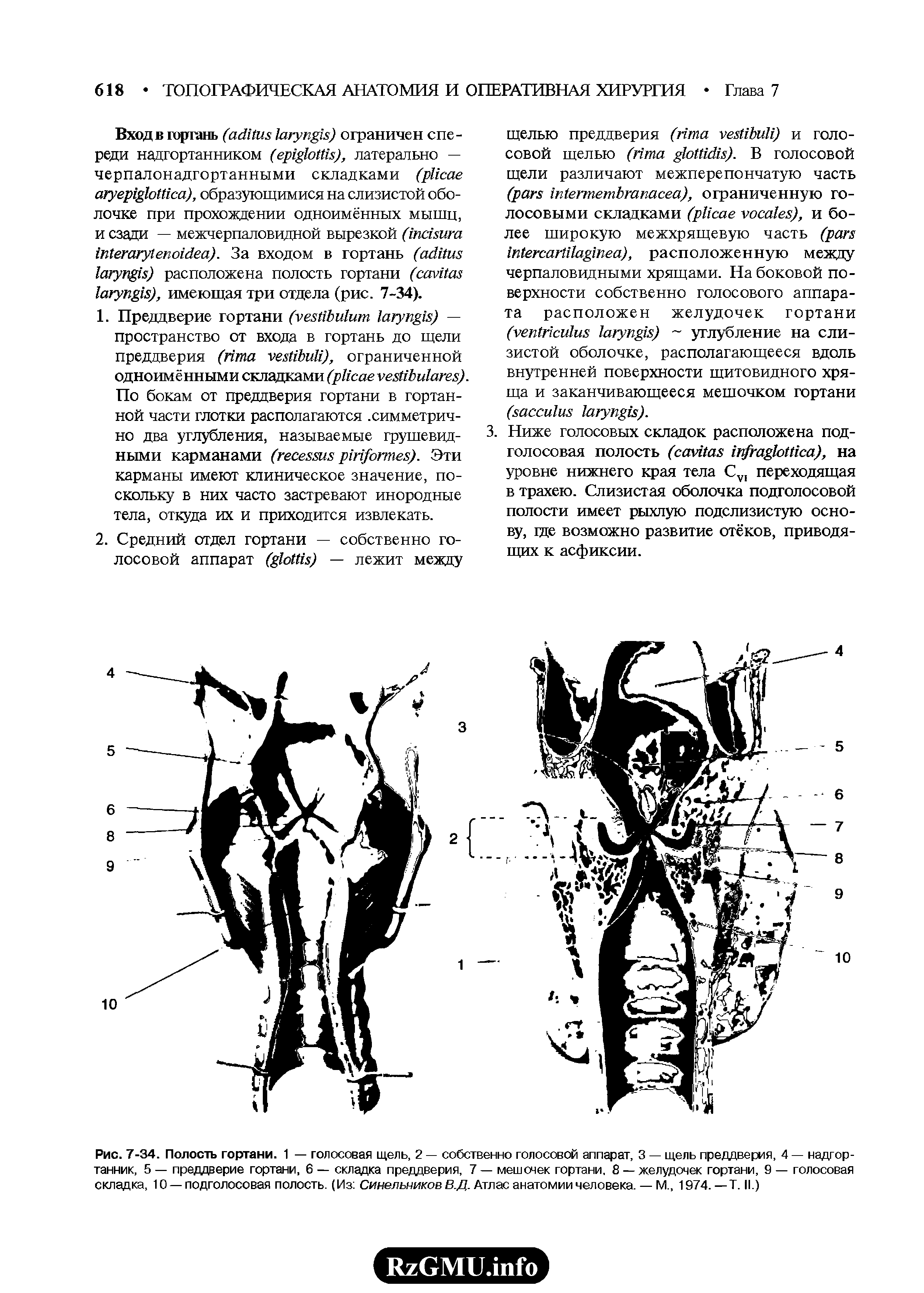 Рис. 7-34. Полость гортани. 1 — голосовая щель, 2 — собственно голосовой аппарат, 3 — щель преддверия, 4 — надгортанник, 5 — преддверие гортани, 6 — складка преддверия, 7 — мешочек гортани, 8 — желудочек гортани, 9 — голосовая складка, 10 — подголосовая полость. (Из Синельников В.Д. Атлас анатомии человека. — М., 1974. —Т. II.)...