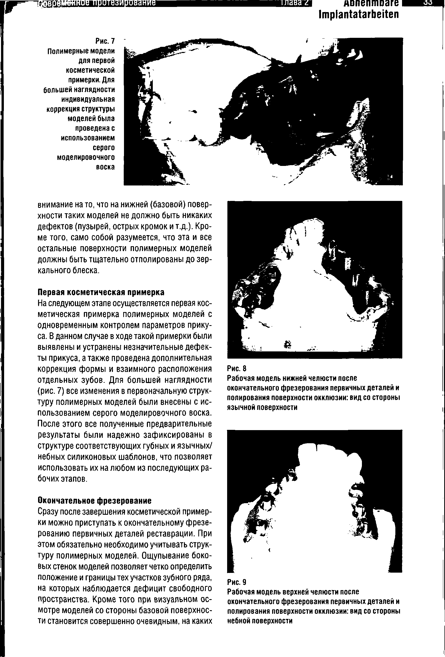 Рис. 7 Полимерные модели для первой косметической примерки. Для большей наглядности индивидуальная коррекция структуры моделей была проведена с использованием серого моделировочного воска...