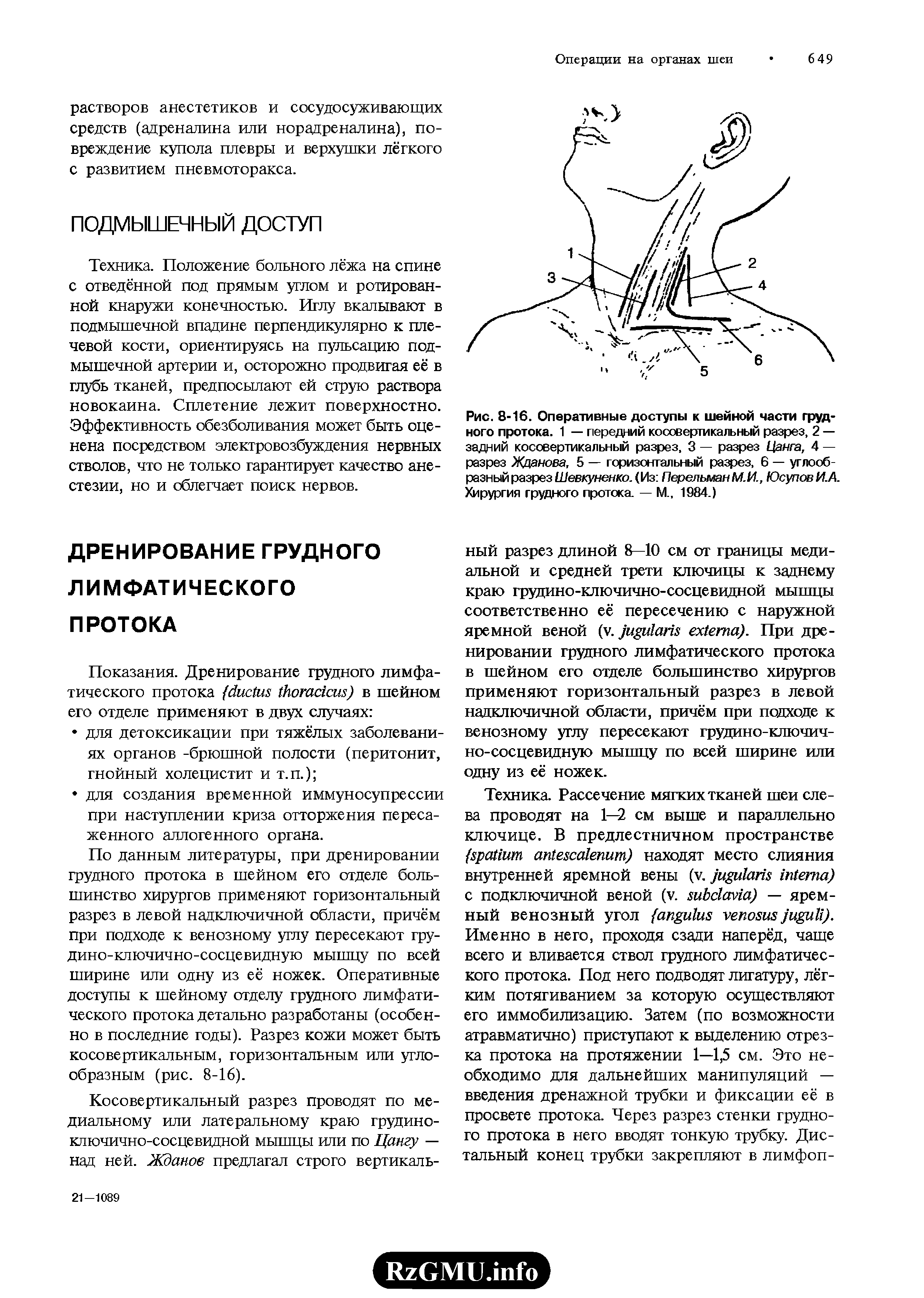 Рис. 8-16. Оперативные доступы к шейной части грудного протока. 1 — передний косовертикальный разрез, 2 — задний косовертикальный разрез, 3 — разрез Цанга, 4 — разрез Жданова, 5 — горизонтальный разрез, 6 — углообразный разрез Шевкуненко. (Из Перельман М.И., Юсупов И.А. Хирургия грудного протока. — М., 1984.)...