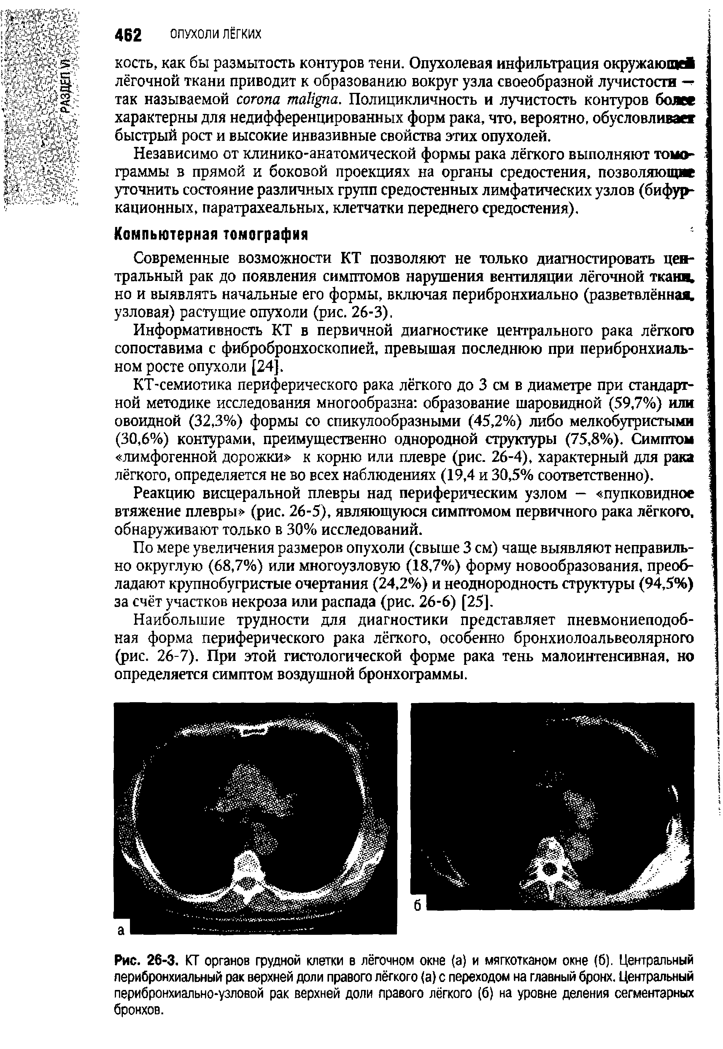 Рис. 26-3. КТ органов грудной клетки в лёгочном окне (а) и мягкотканом окне (б). Центральный лерибронхиальный рак верхней доли правого лёгкого (а) с переходом на главный бронх. Центральный перибронхиально-узловой рак верхней доли правого лёгкого (б) на уровне деления сегментарных бронхов.