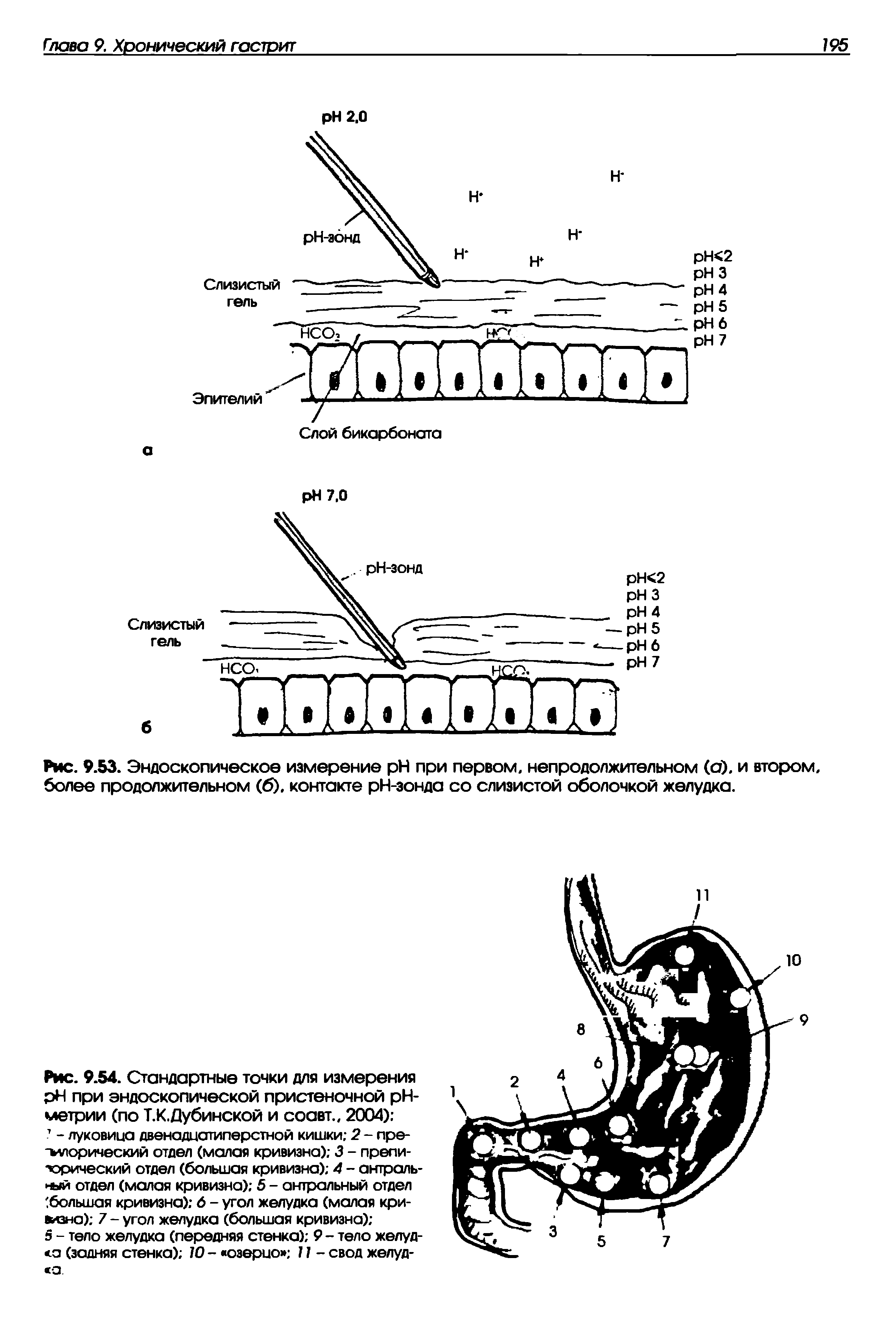 Рис. 9.54. Стандартные точки для измерения H при эндоскопической пристеночной рН-метрии (по Т.К.Дубинской и соавт., 2004) - луковица двенадцатиперстной кишки 2 - пре-тилорический отдел (малая кривизна) 3 - препи-тэрический отдел (большая кривизна) 4 - антраль- -ый отдел (малая кривизна) 5 - антральный отдел большая кривизна) 6 - угол желудка (малая кривизна) 7 - угол желудка (большая кривизна) ...