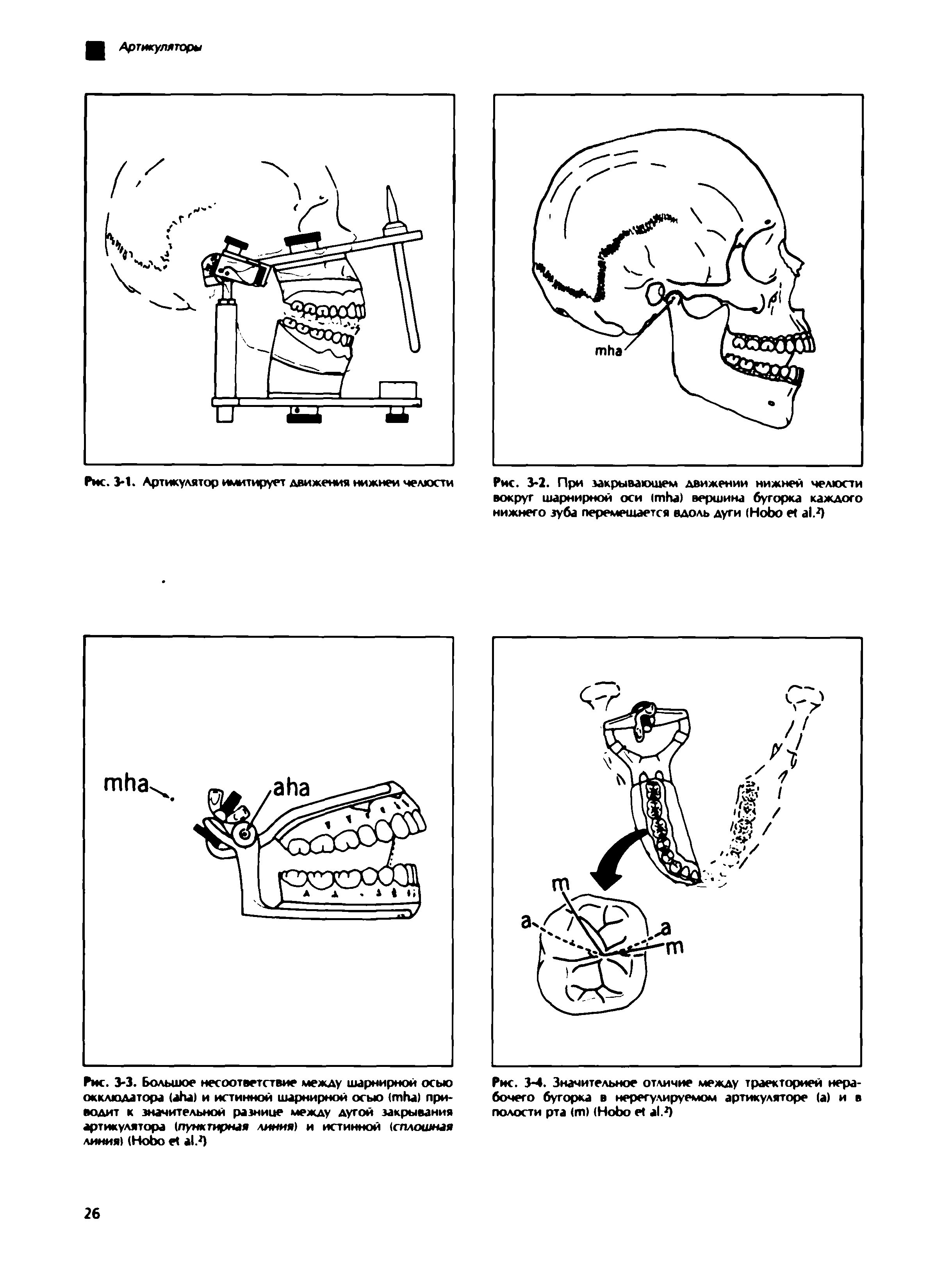 Рис. 3-4. Значительное отличие между траекторией нерабочего бугорка в нерегулируемом артикуляторе (а) и в полости рта ( ) (H .2)...