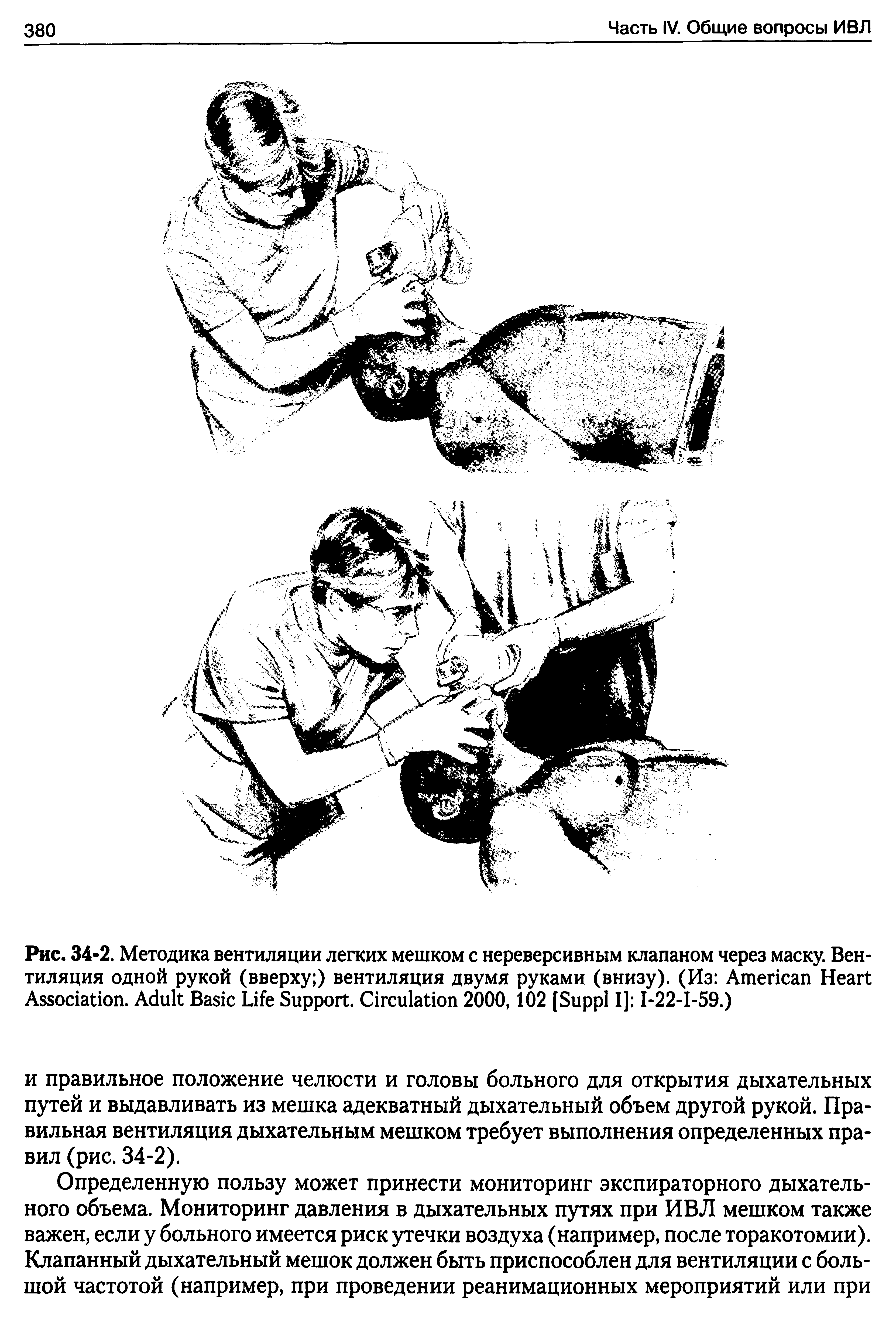 Рис. 34-2. Методика вентиляции легких мешком с нереверсивным клапаном через маску. Вентиляция одной рукой (вверху ) вентиляция двумя руками (внизу). (Из A H A . A B L S . C 2000,102 [S I] I-22-I-59.)...