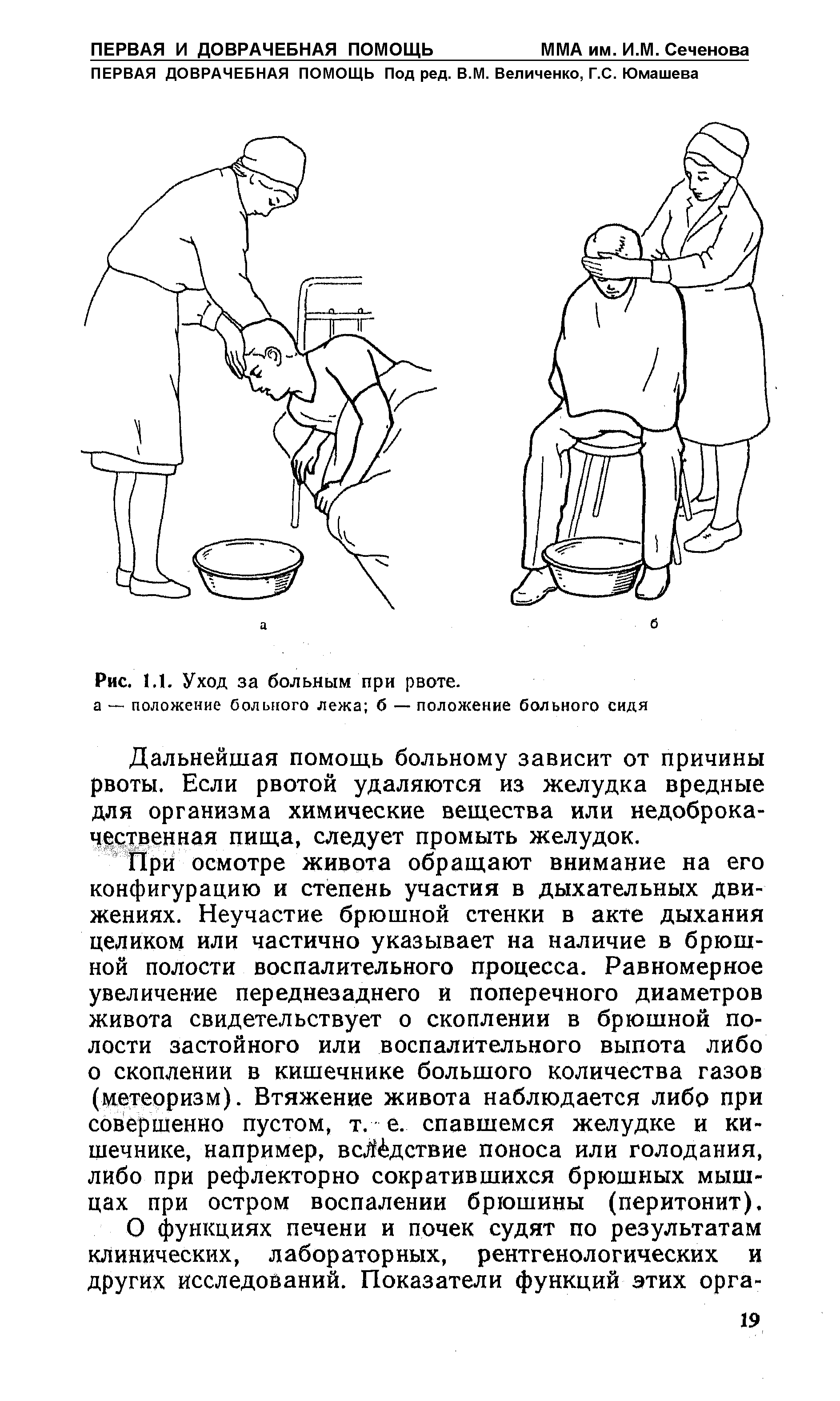 Рис. 1.1. Уход за больным при рвоте, а — положение больного лежа б — положение больного сидя...