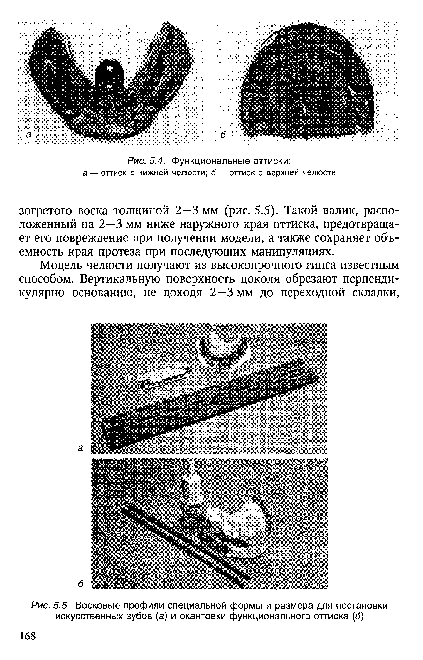 Рис. 5.5. Восковые профили специальной формы и размера для постановки искусственных зубов (а) и окантовки функционального оттиска (6)...