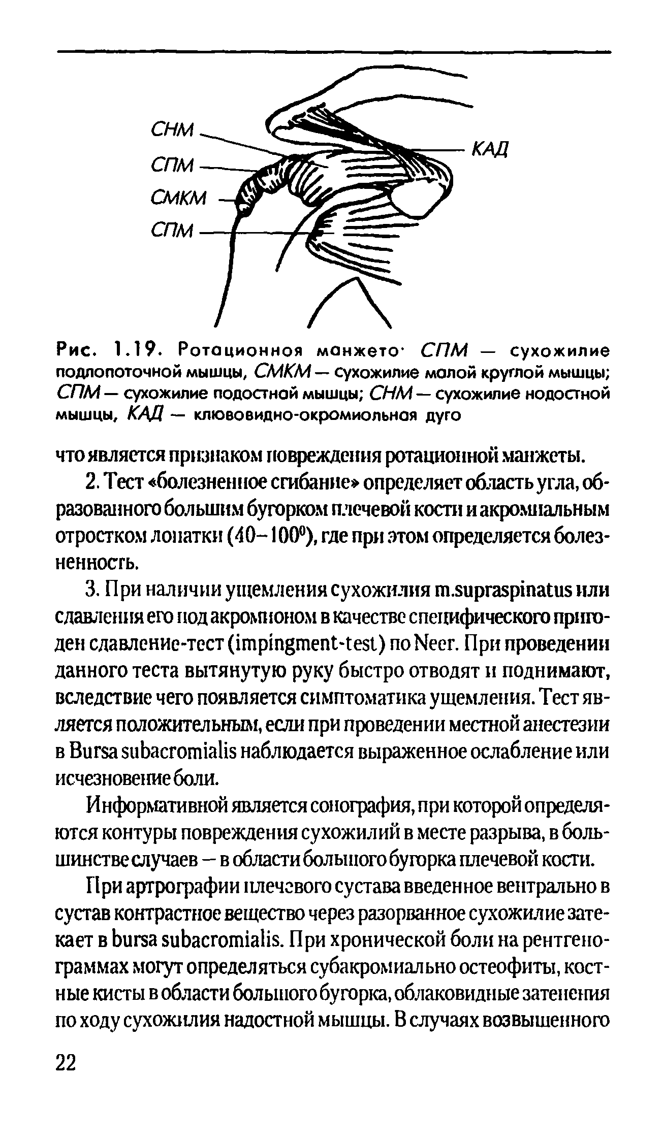 Рис. 1.19. Ротационноя манжето СПМ — сухожилие подлопоточной мышцы, СМКМ — сухожилие малой круглой мышцы СПМ — сухожилие подостной мышцы СНМ — сухожилие нодостной мышцы, КАД — клювовидно-окромиольная дуго...