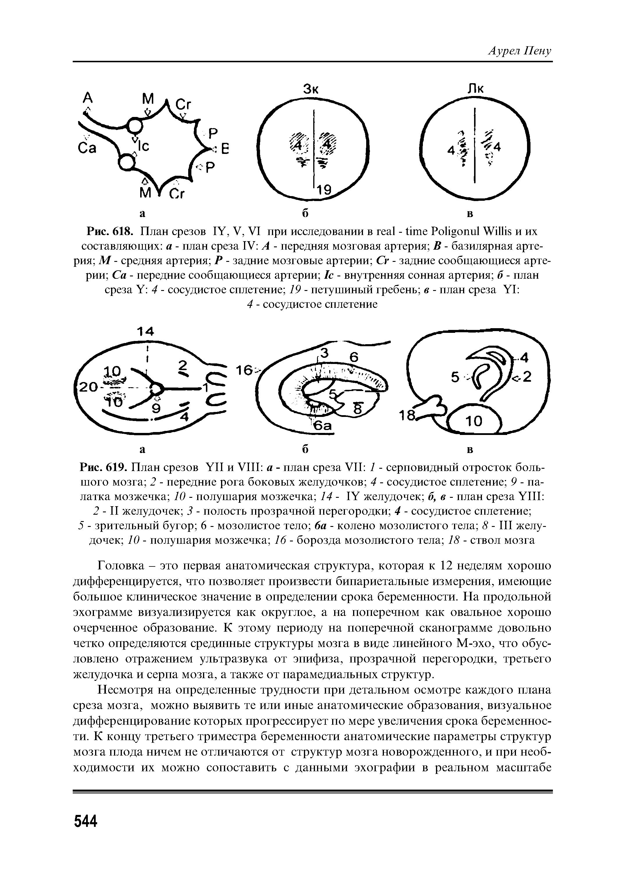 Рис. 619. План срезов YII и VIII а - план среза VII 1 - серповидный отросток большого мозга 2 - передние рога боковых желудочков 4 - сосудистое сплетение 9 - палатка мозжечка 10 - полушария мозжечка 14 - IY желудочек б, в - план среза YIII ...