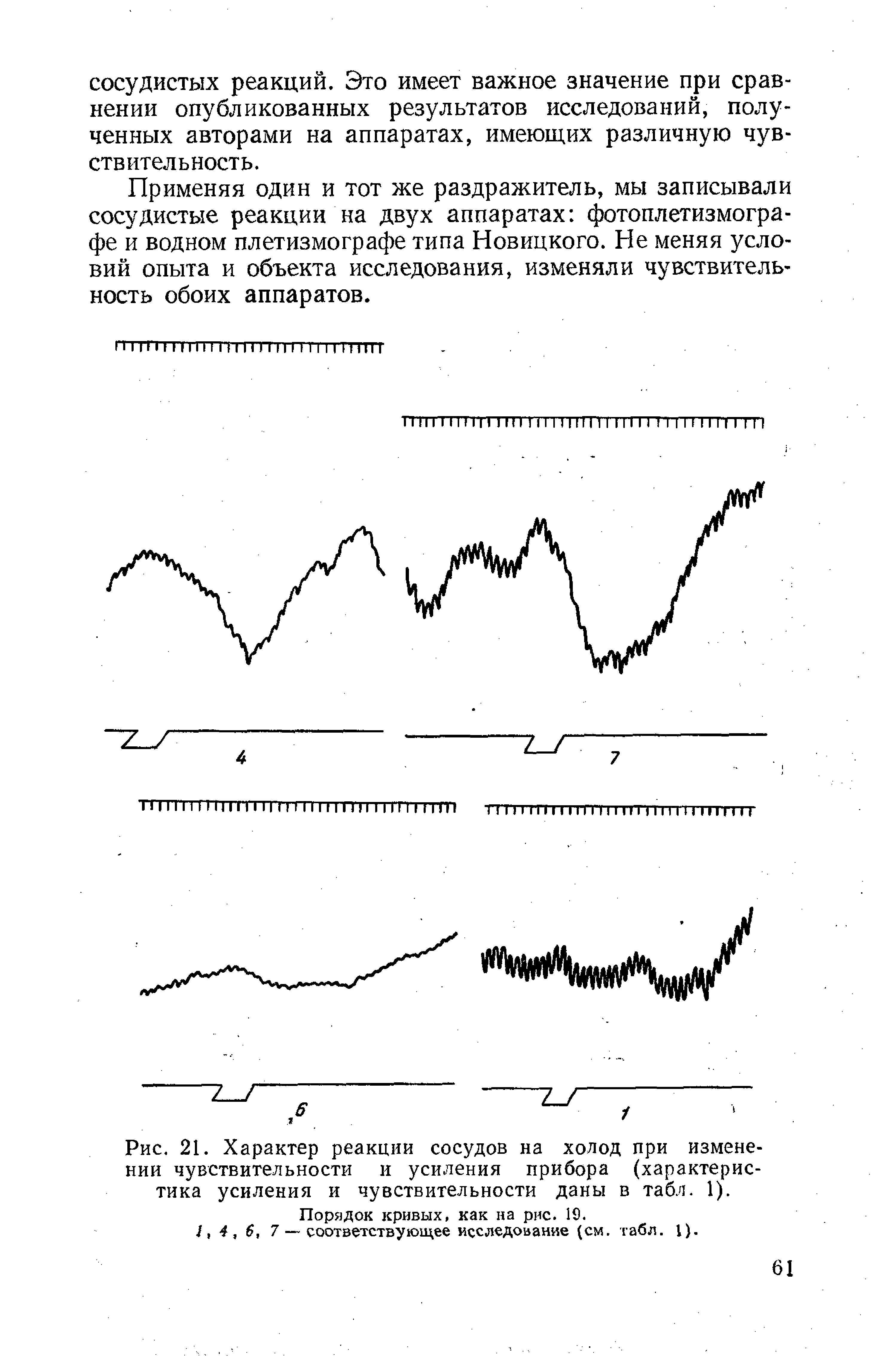 Рис. 21. Характер реакции сосудов на холод при изменении чувствительности и усиления прибора (характеристика усиления и чувствительности даны в табл. 1).