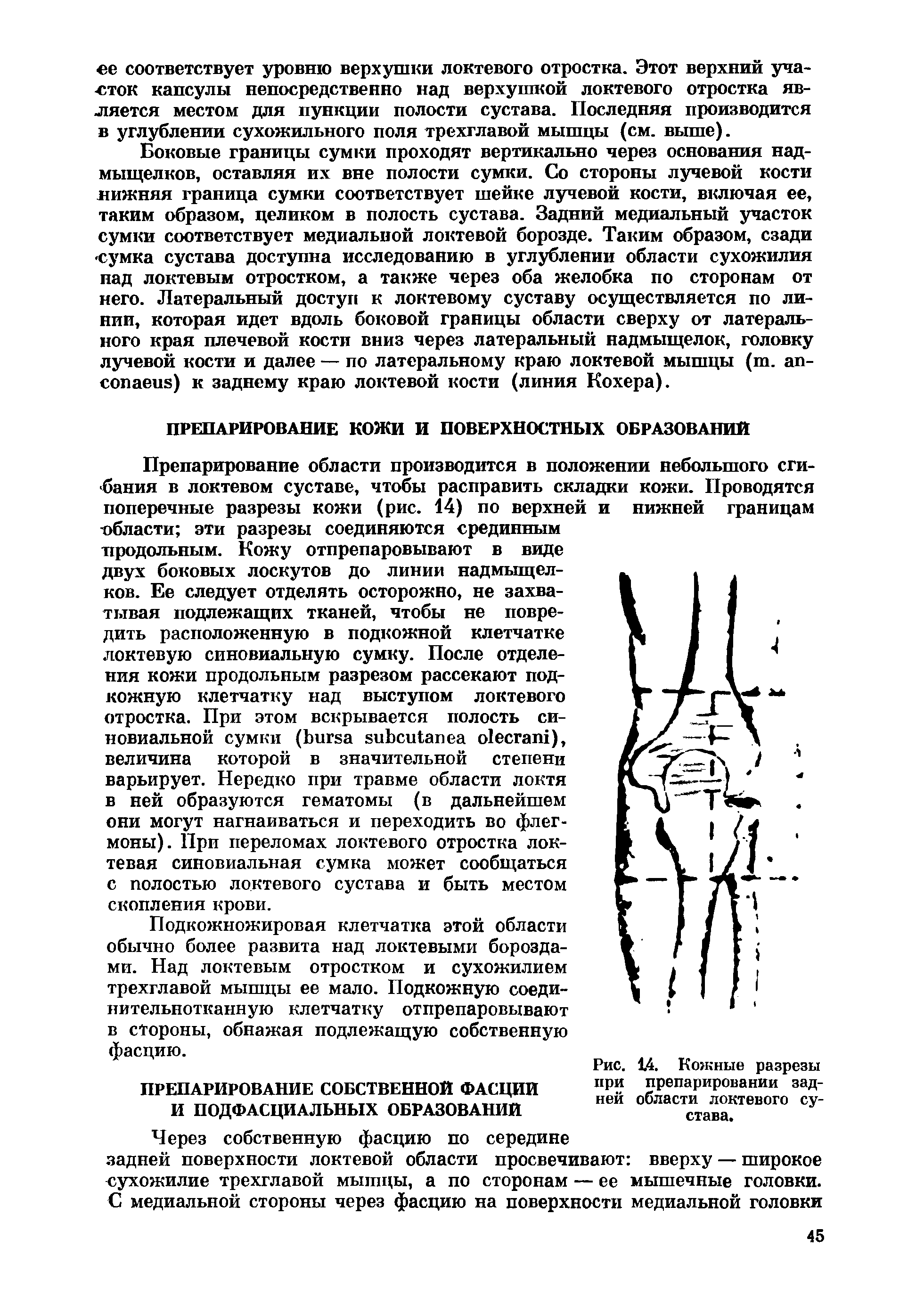 Рис. 14. Кожные разрезы при препарировании задней области локтевого сустава.