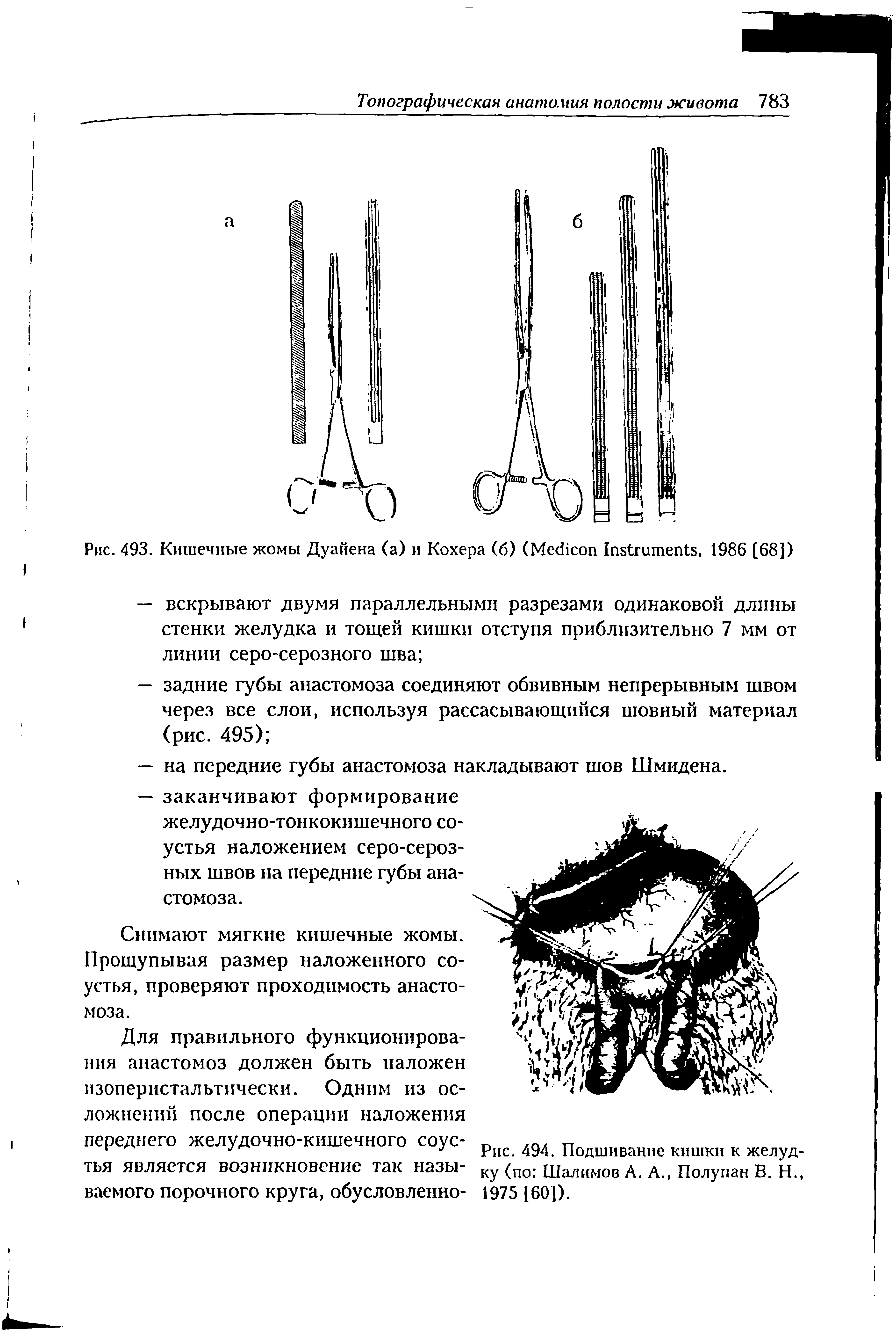 Рис. 493. Кишечные жомы Дуайена (а) и Кохера (б) (M I , 1986 [68])...