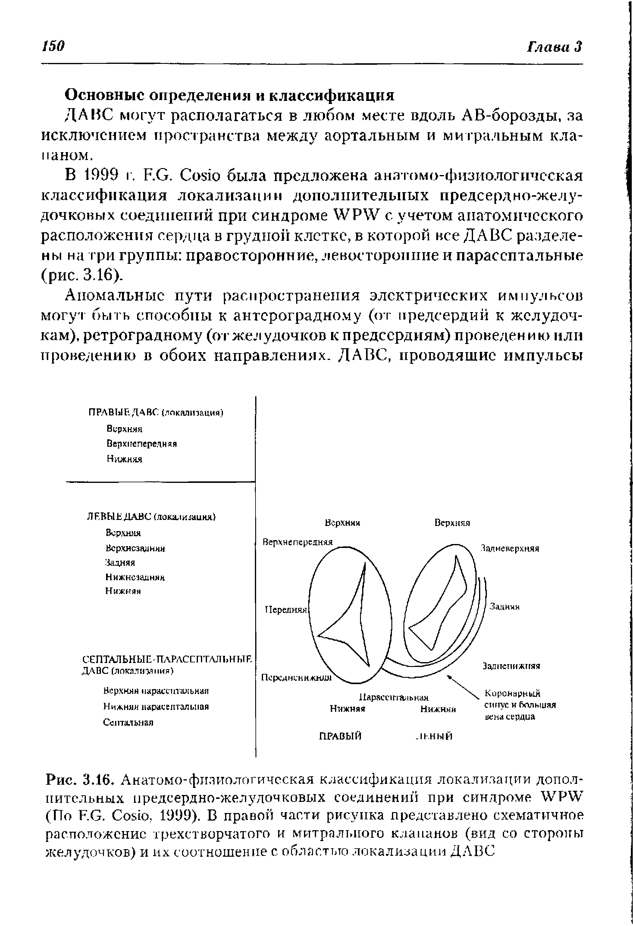 Рис. 3.16. Анатомо-физиологическая классификация локализации дополнительных предсердно-желудочковых соединений при синдроме WPW (По F.G. C , 1999). В правой части рисунка представлено схематичное расположение трехстворчатого и митрального клапанов (вид со стороны желудочков) и их соотношение с областью локализации ДАВС...