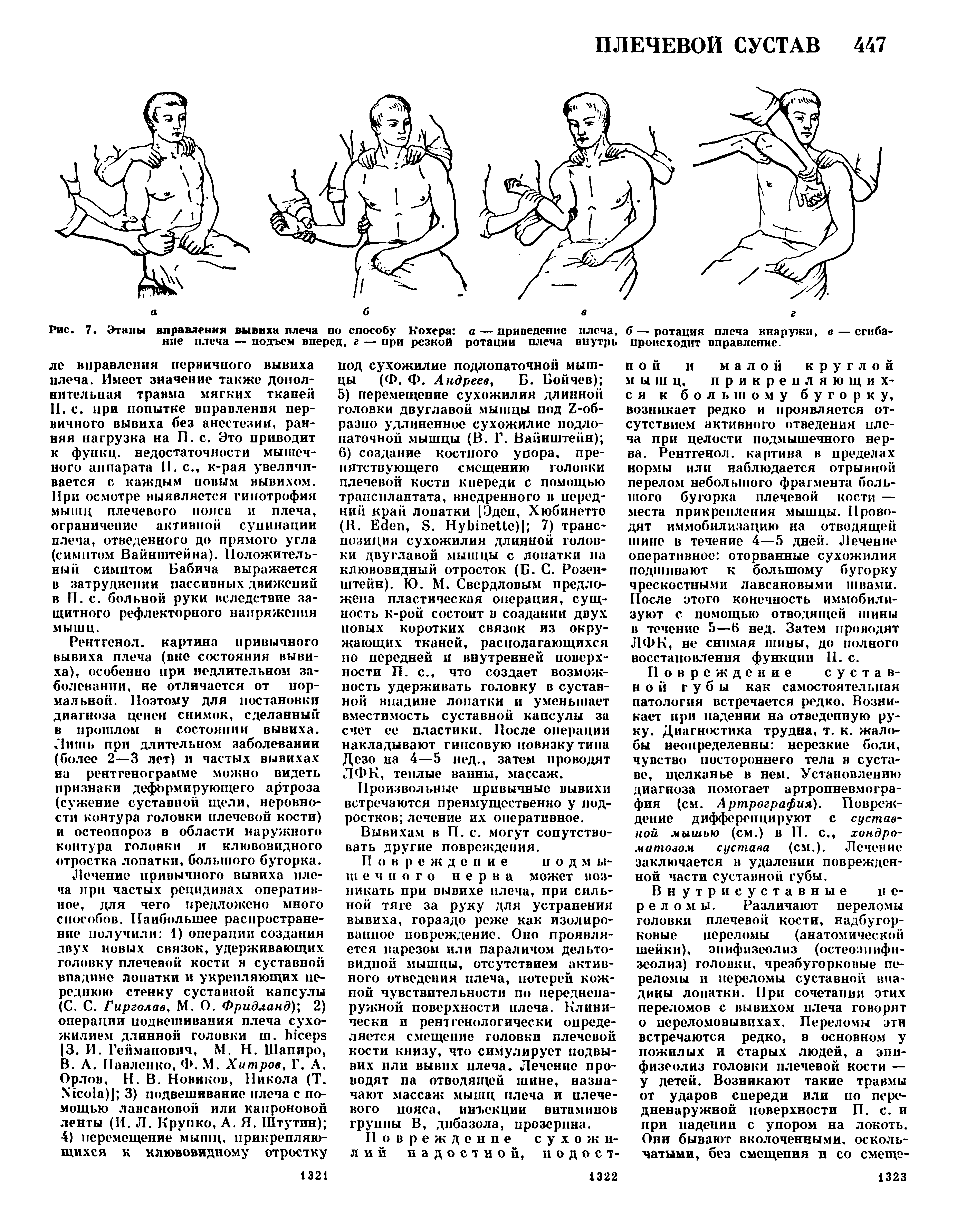 Рис. 7. Этапы вправления вывиха плеча по способу Кохера а — приведение плеча, б — ротация плеча кнаружи, в — сгибание плеча — подъем вперед, г — при резкой ротации плеча внутрь происходит вправление.