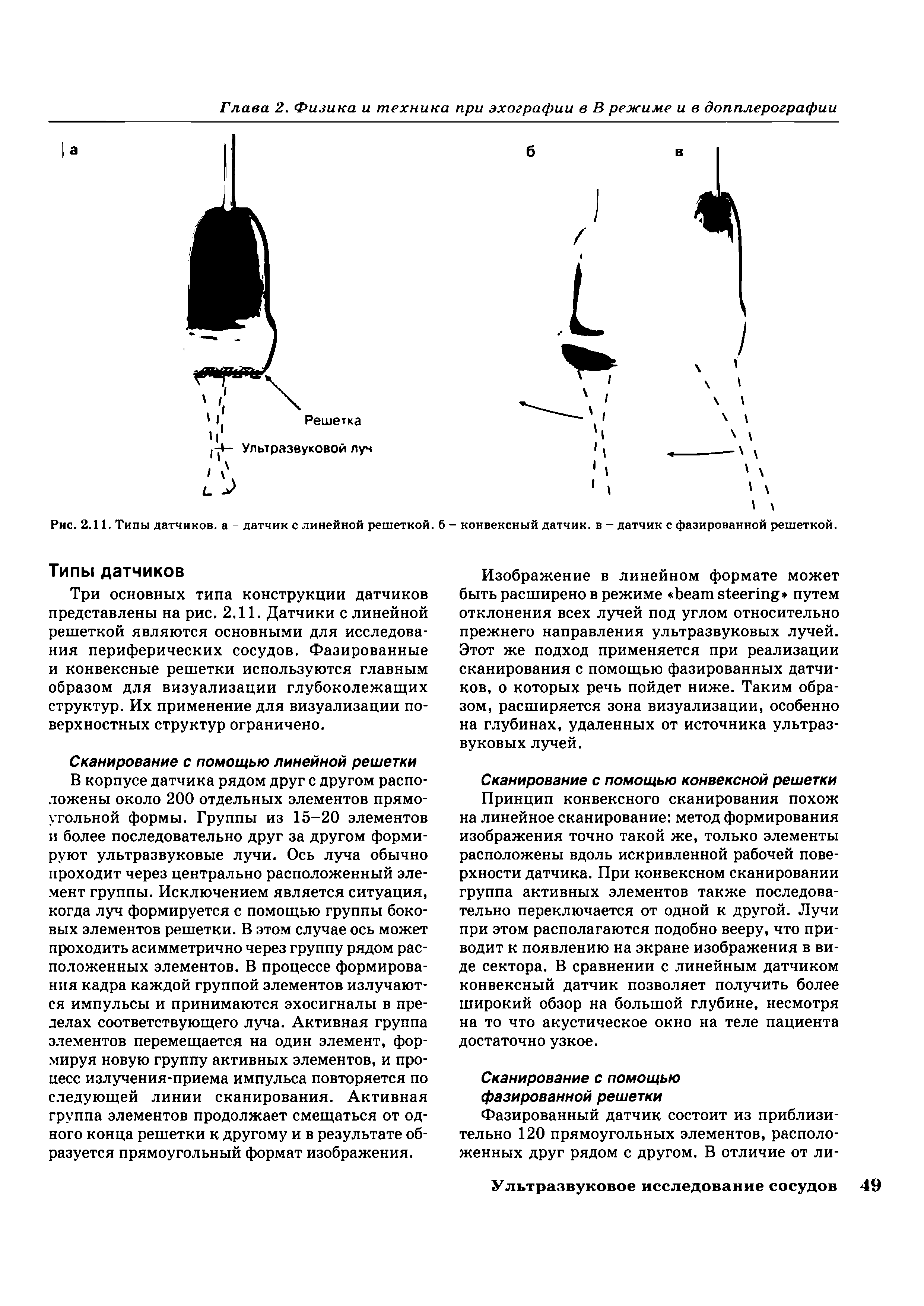 Рис. 2.11. Типы датчиков, а - датчик с линейной решеткой, б - конвексный датчик, в - датчик с фазированной решеткой.